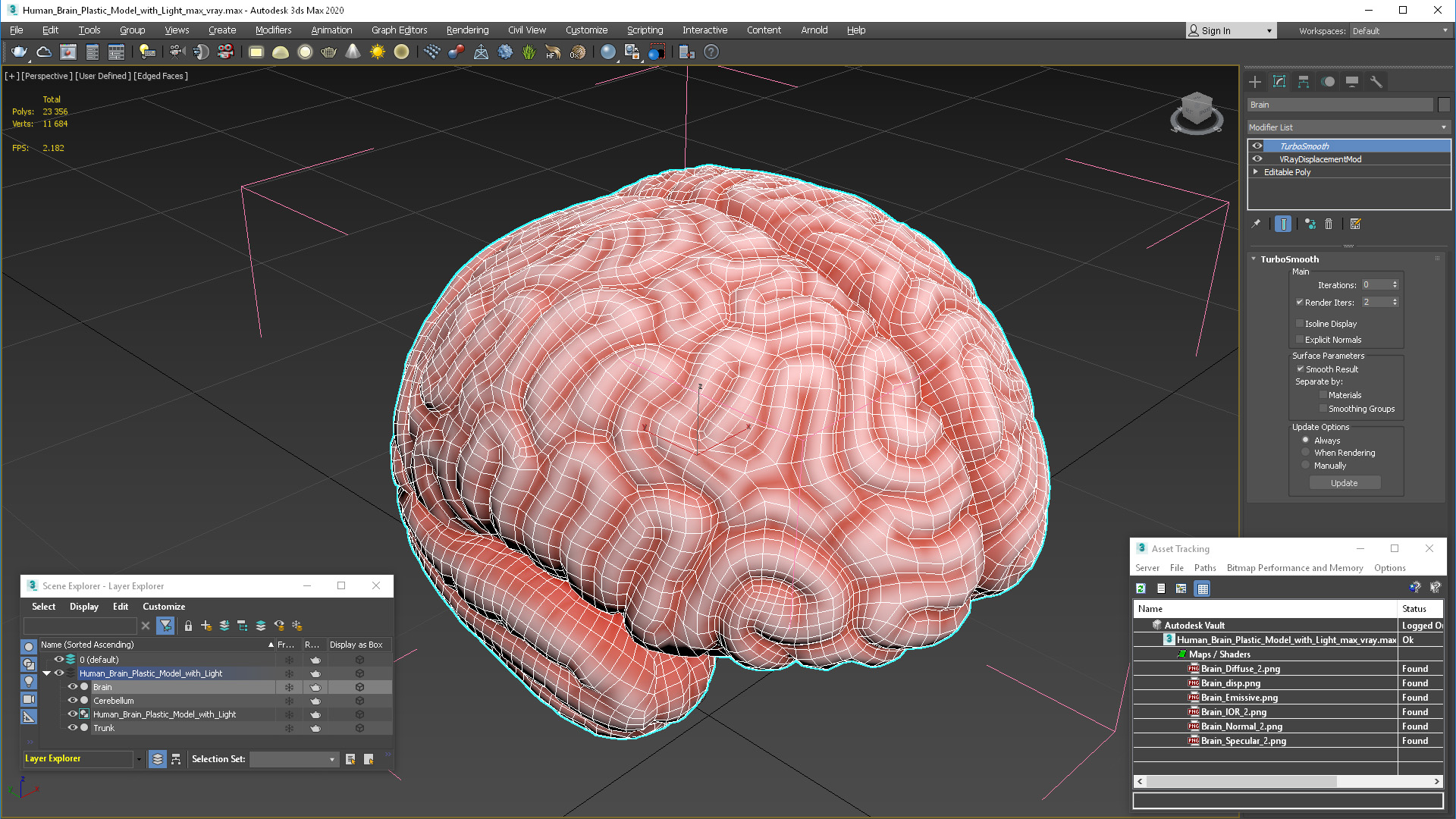 3D Human Brain Plastic Model with Light