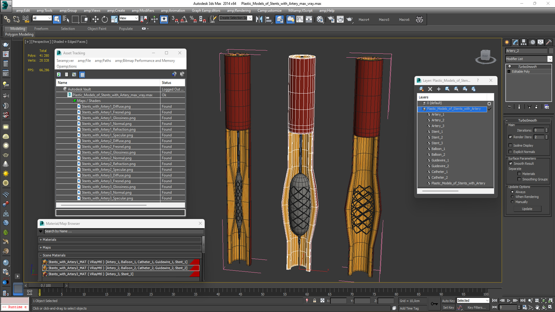 3D Plastic Models of Stents with Artery