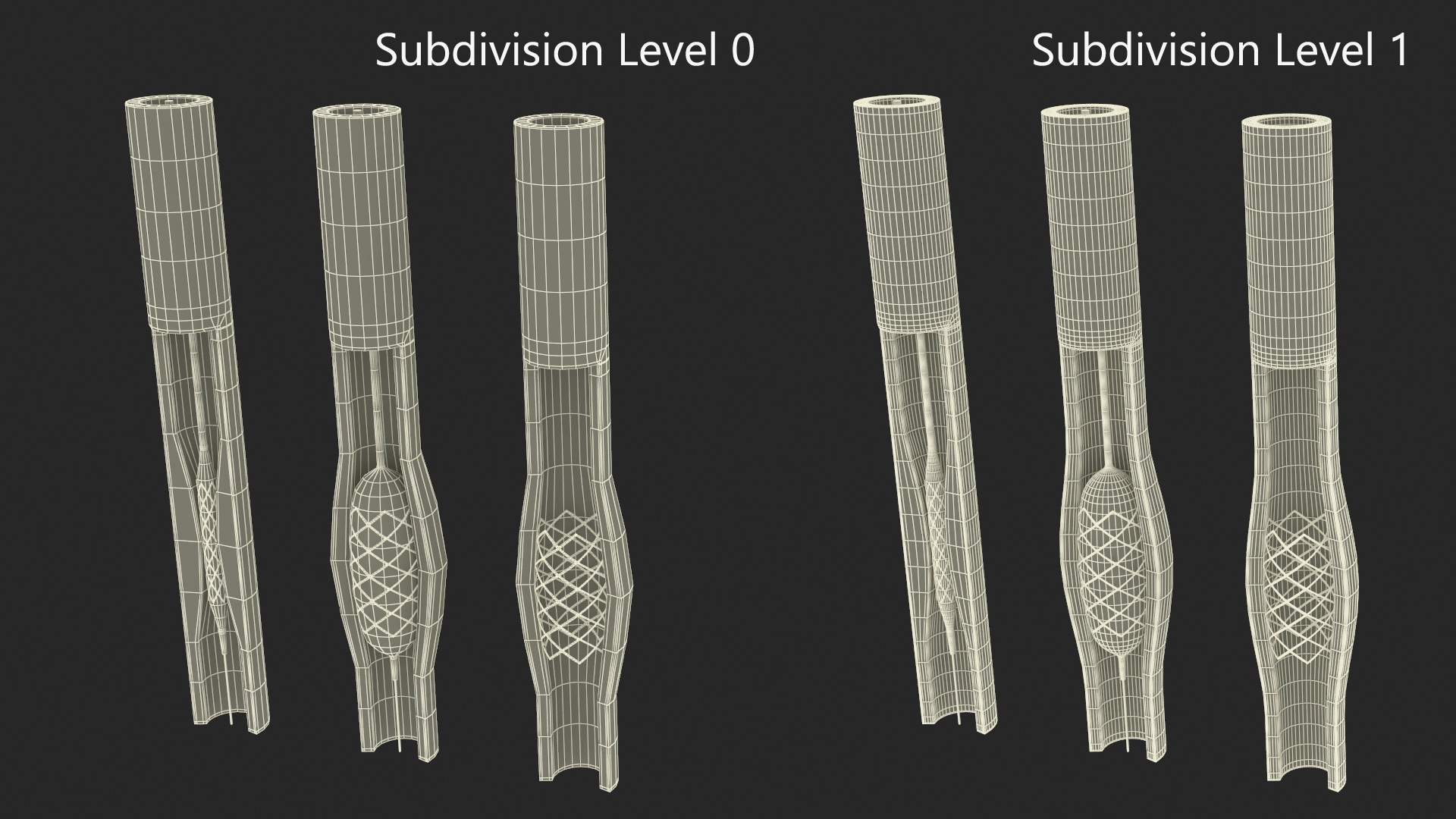 3D Plastic Models of Stents with Artery