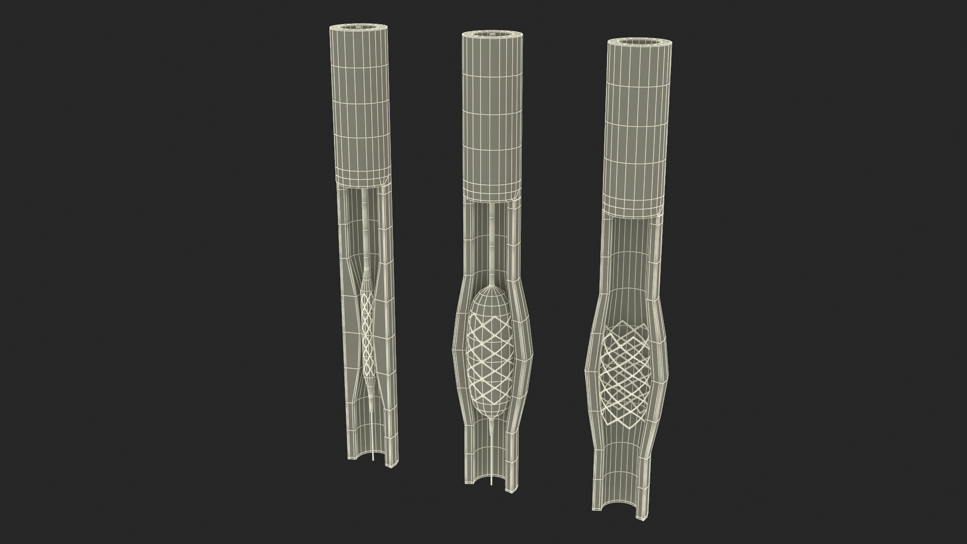 3D Plastic Models of Stents with Artery