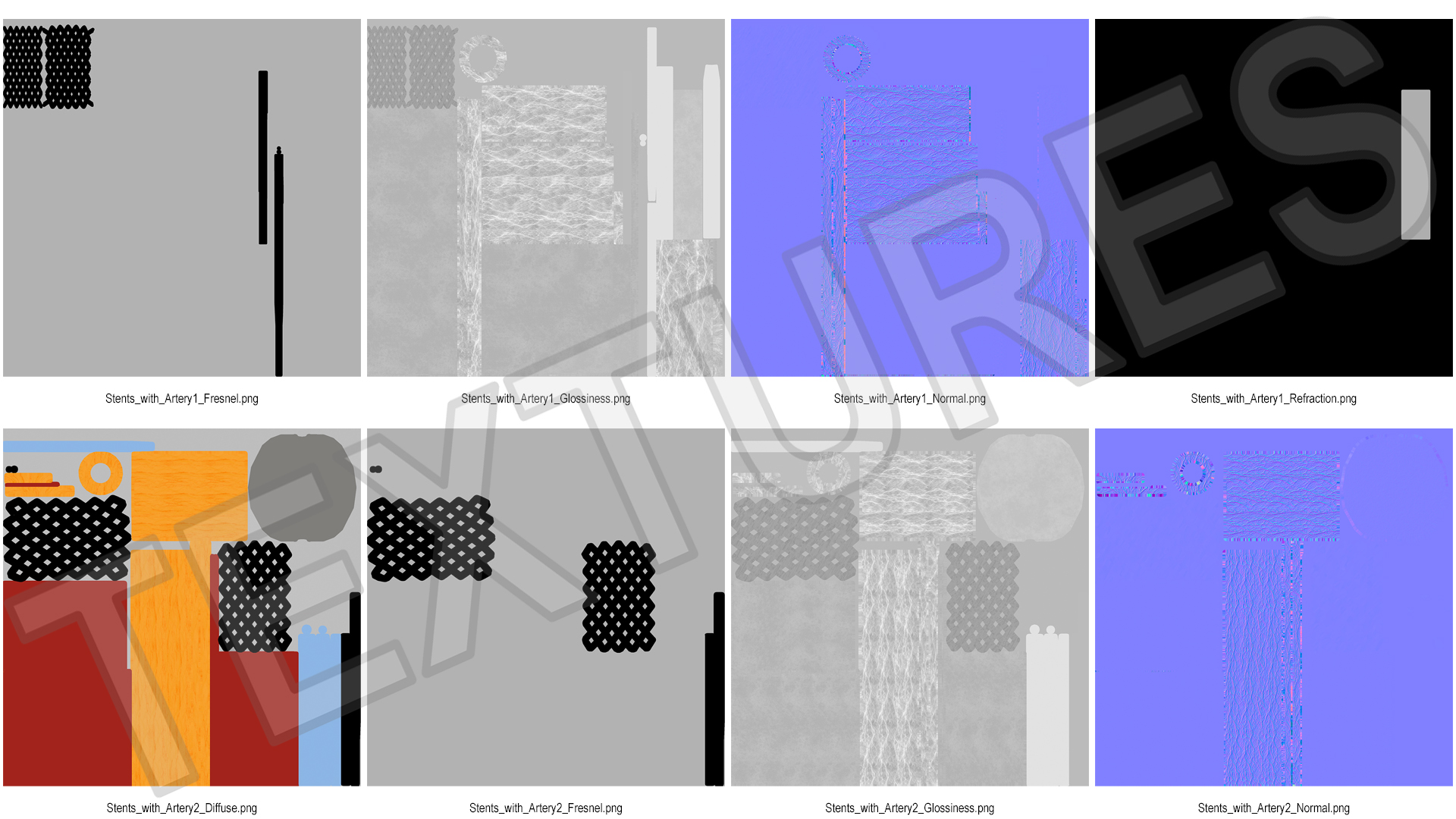 3D Plastic Models of Stents with Artery