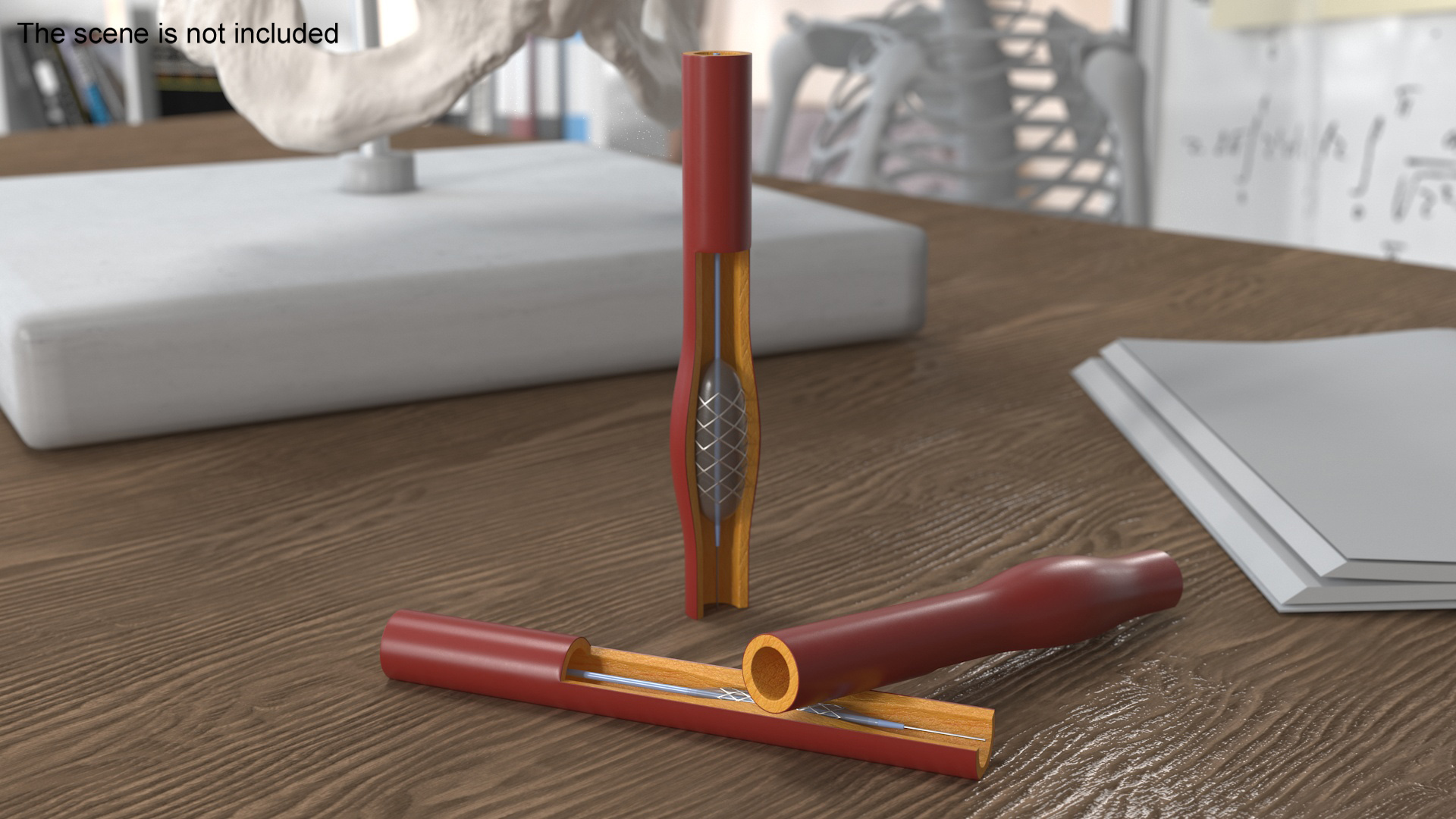 3D Plastic Models of Stents with Artery