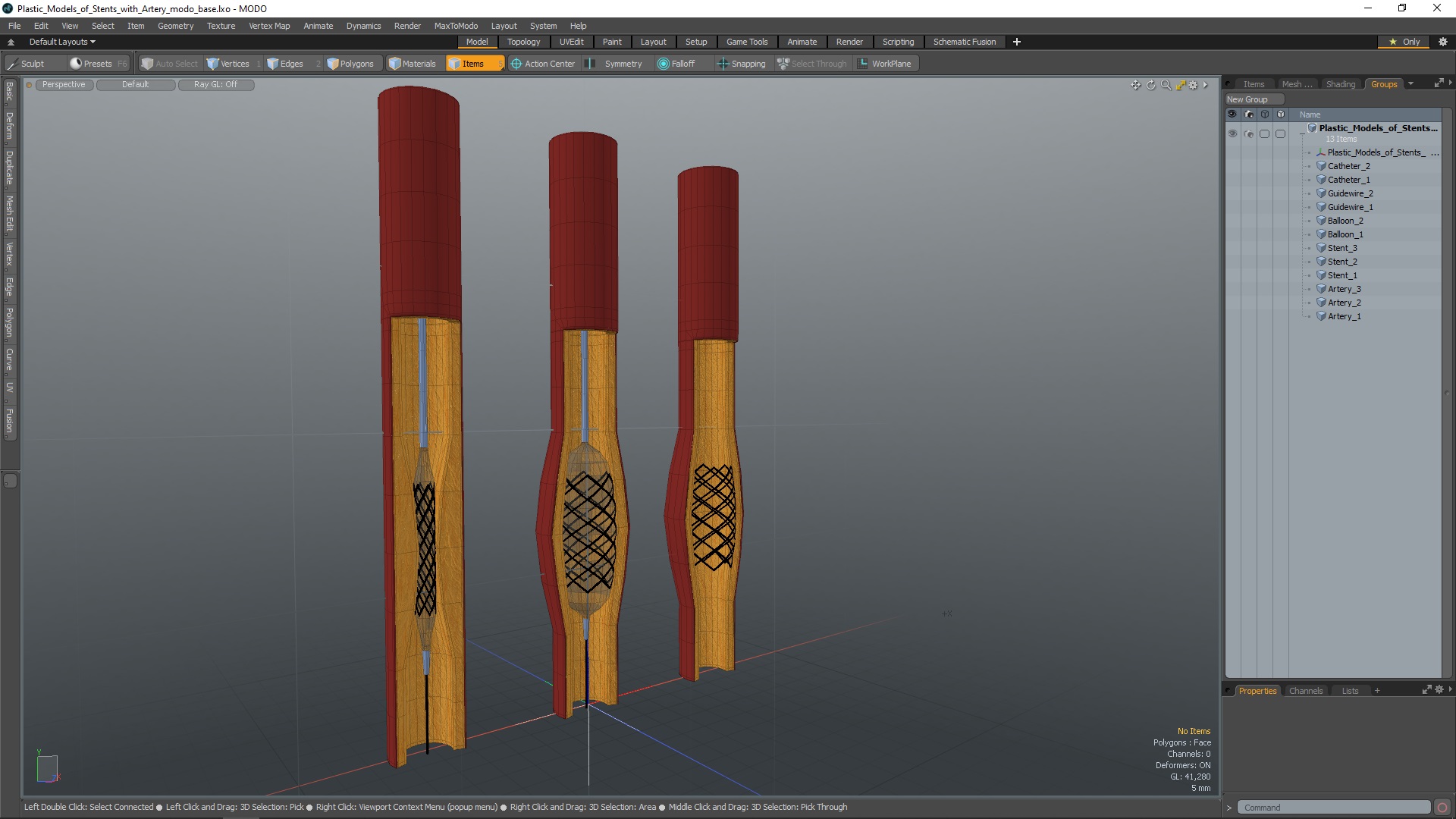 3D Plastic Models of Stents with Artery