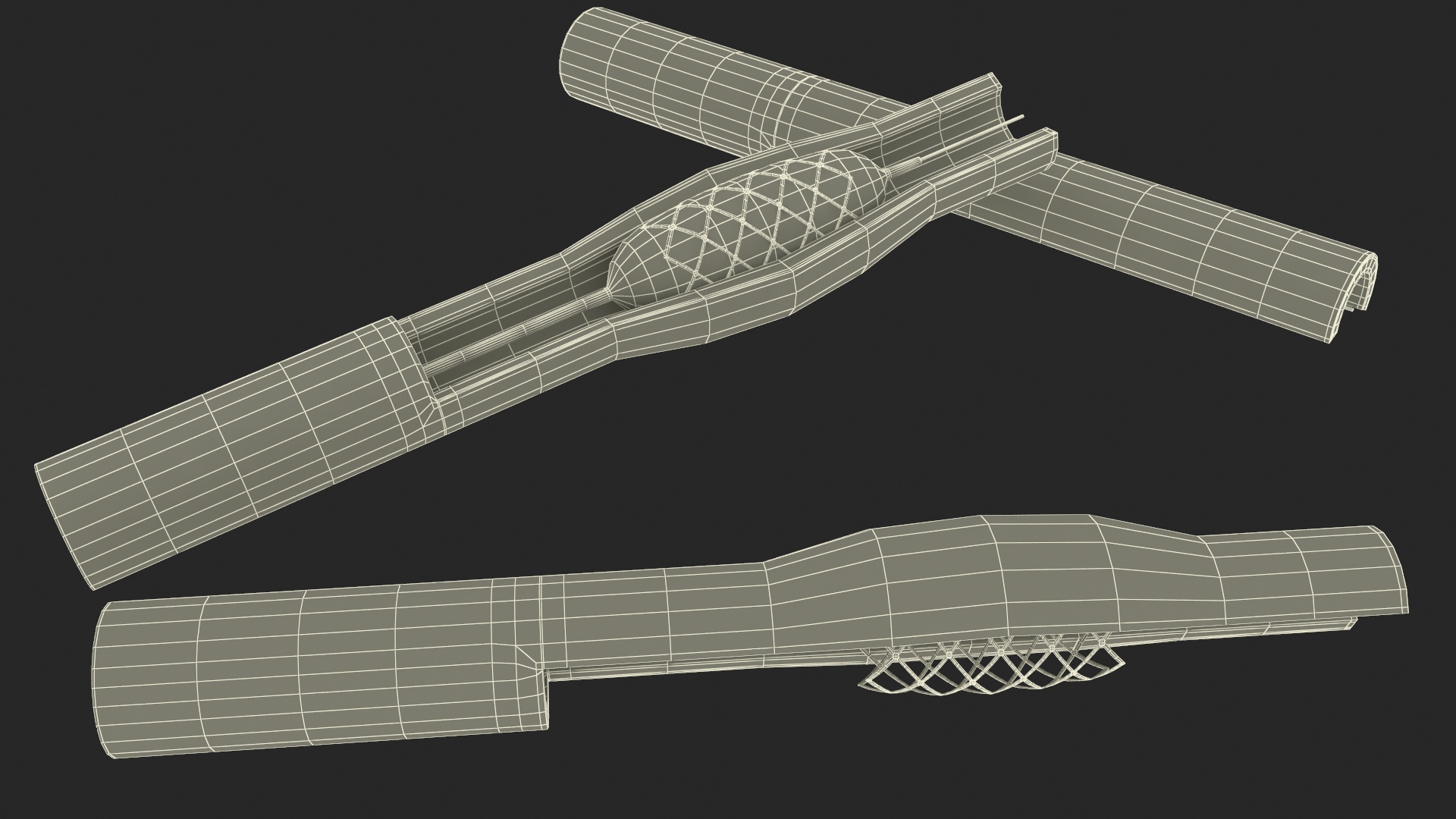 3D Plastic Models of Stents with Artery