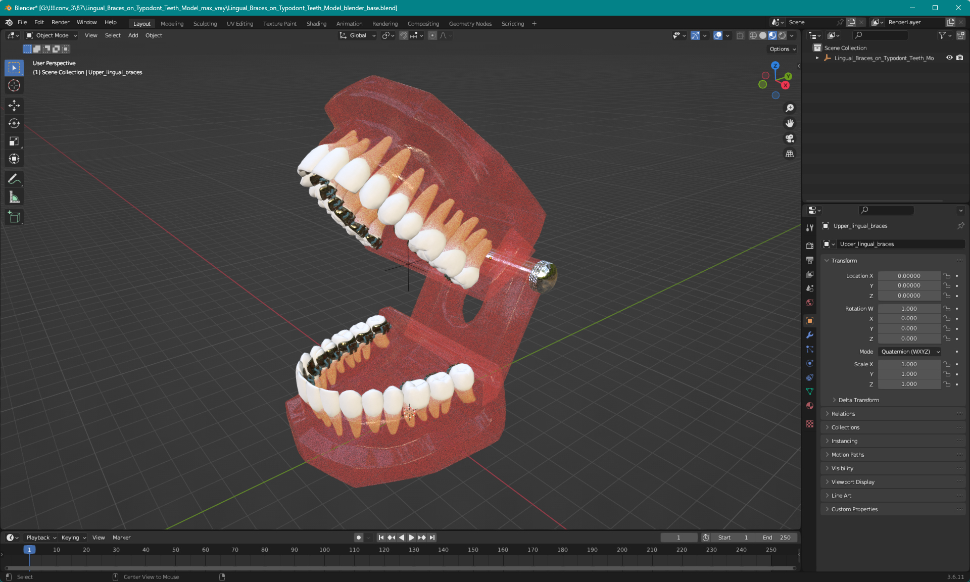 3D Lingual Braces on Typodont Teeth Model model