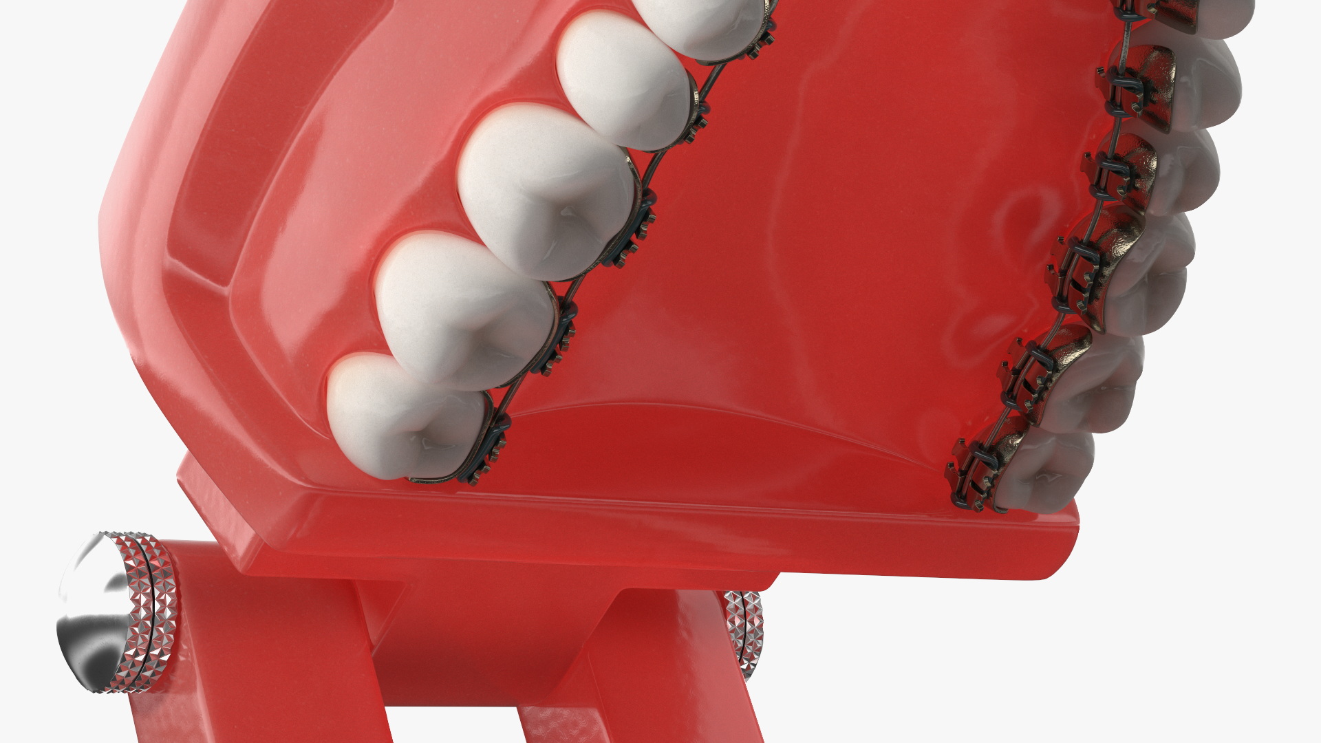 3D Lingual Braces on Typodont Teeth Model model