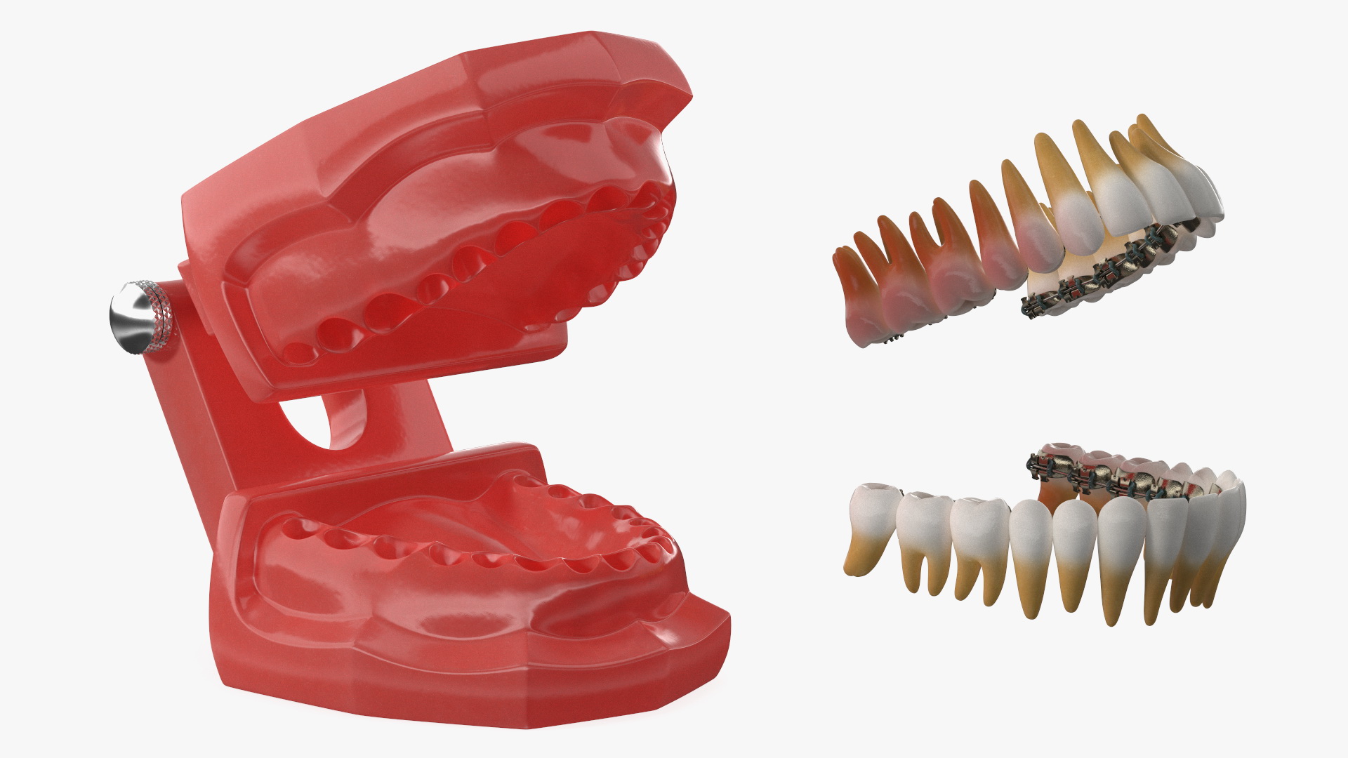 3D Lingual Braces on Typodont Teeth Model model