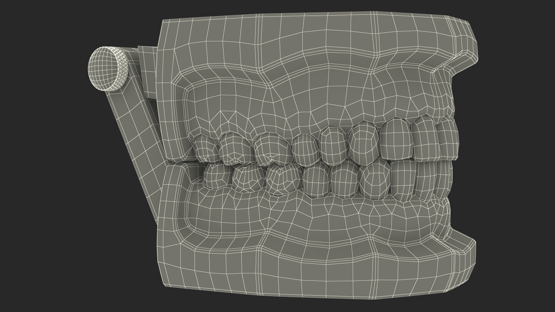 3D Lingual Braces on Typodont Teeth Model model