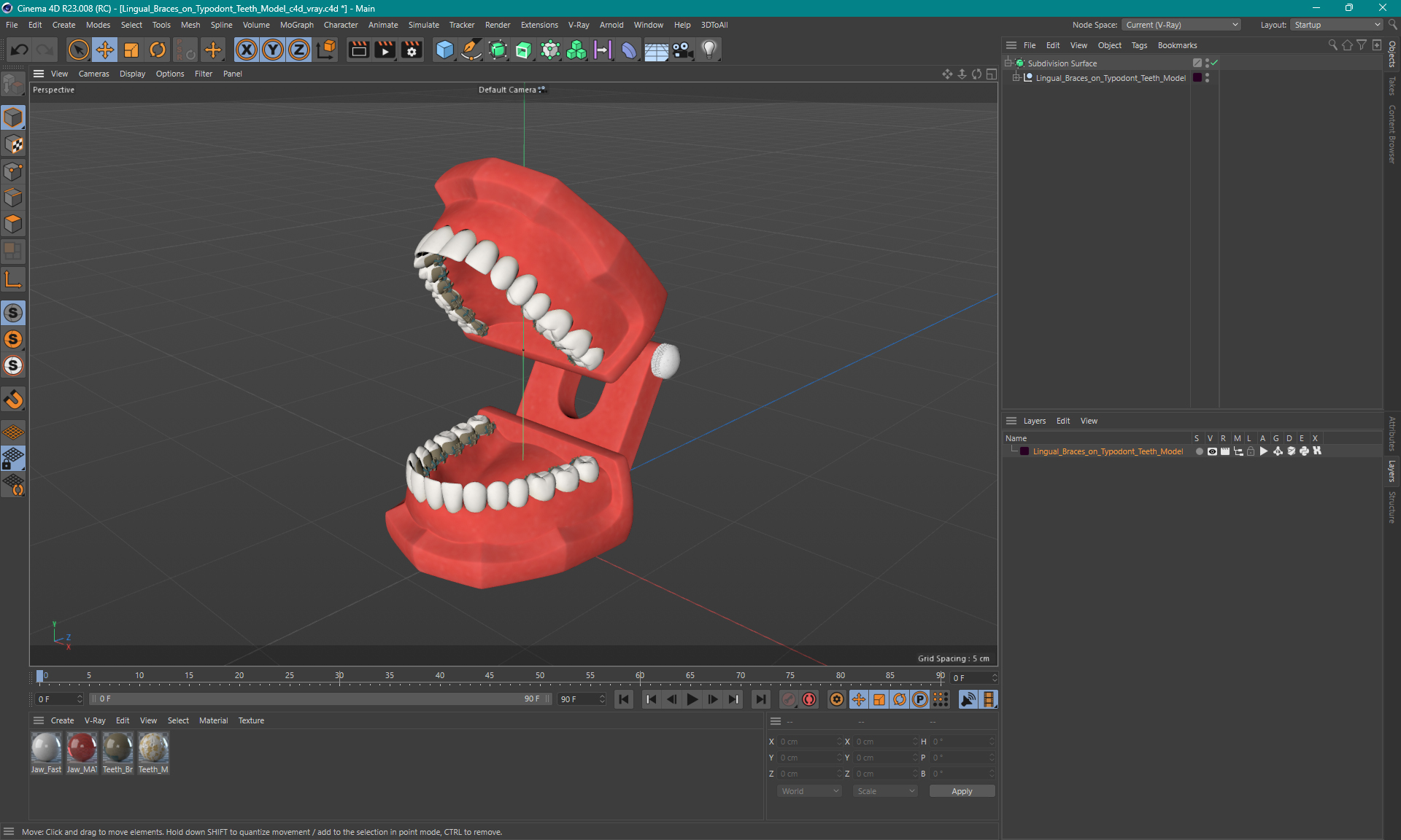 3D Lingual Braces on Typodont Teeth Model model