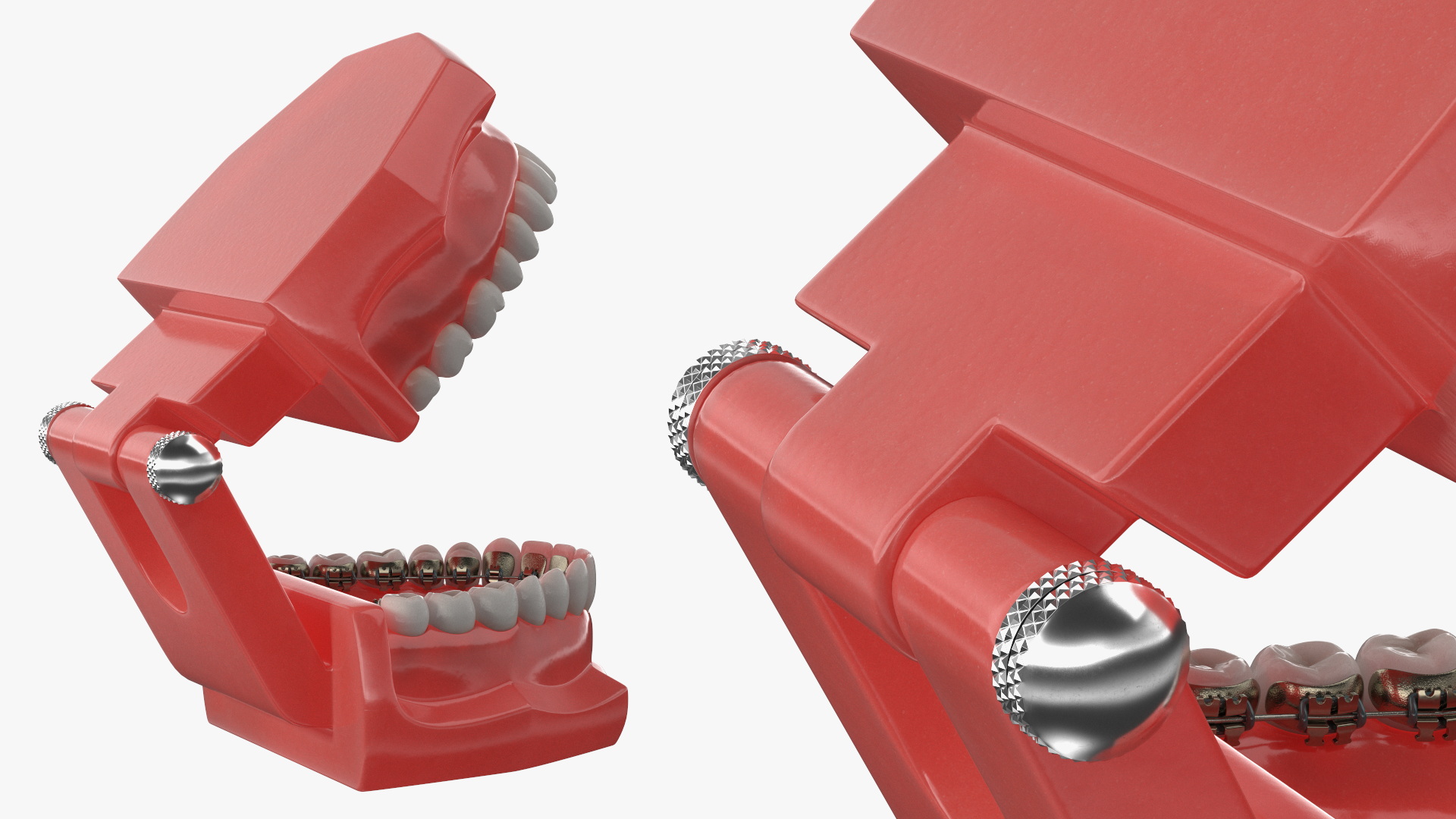 3D Lingual Braces on Typodont Teeth Model model
