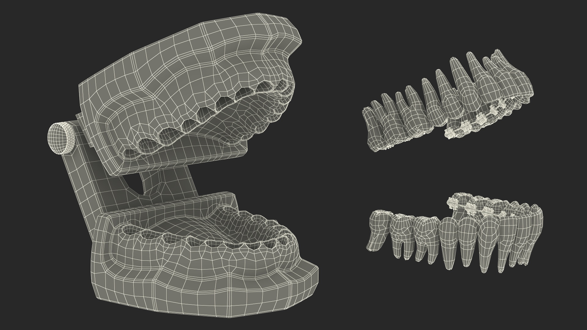 3D Lingual Braces on Typodont Teeth Model model