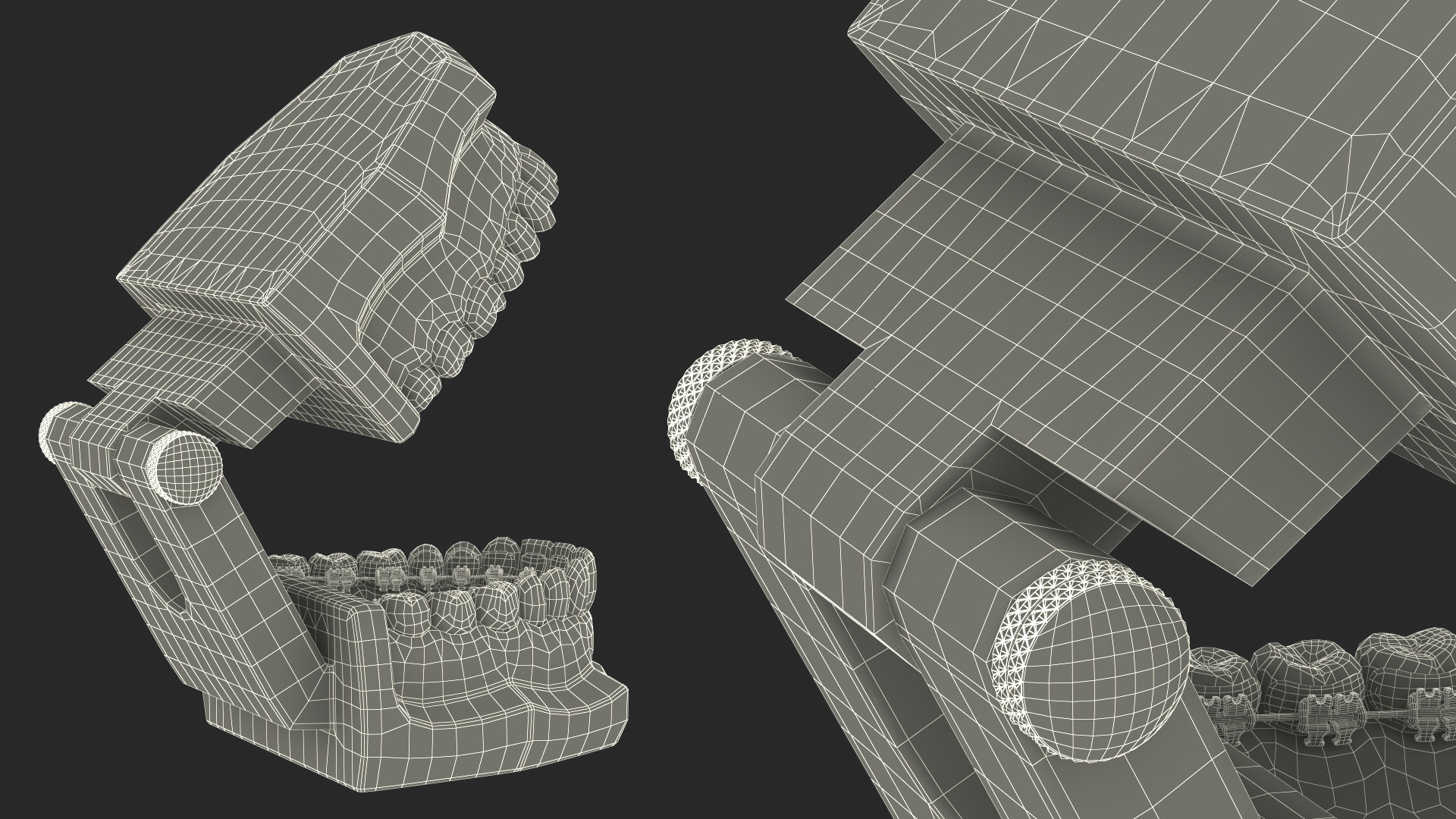 3D Lingual Braces on Typodont Teeth Model model
