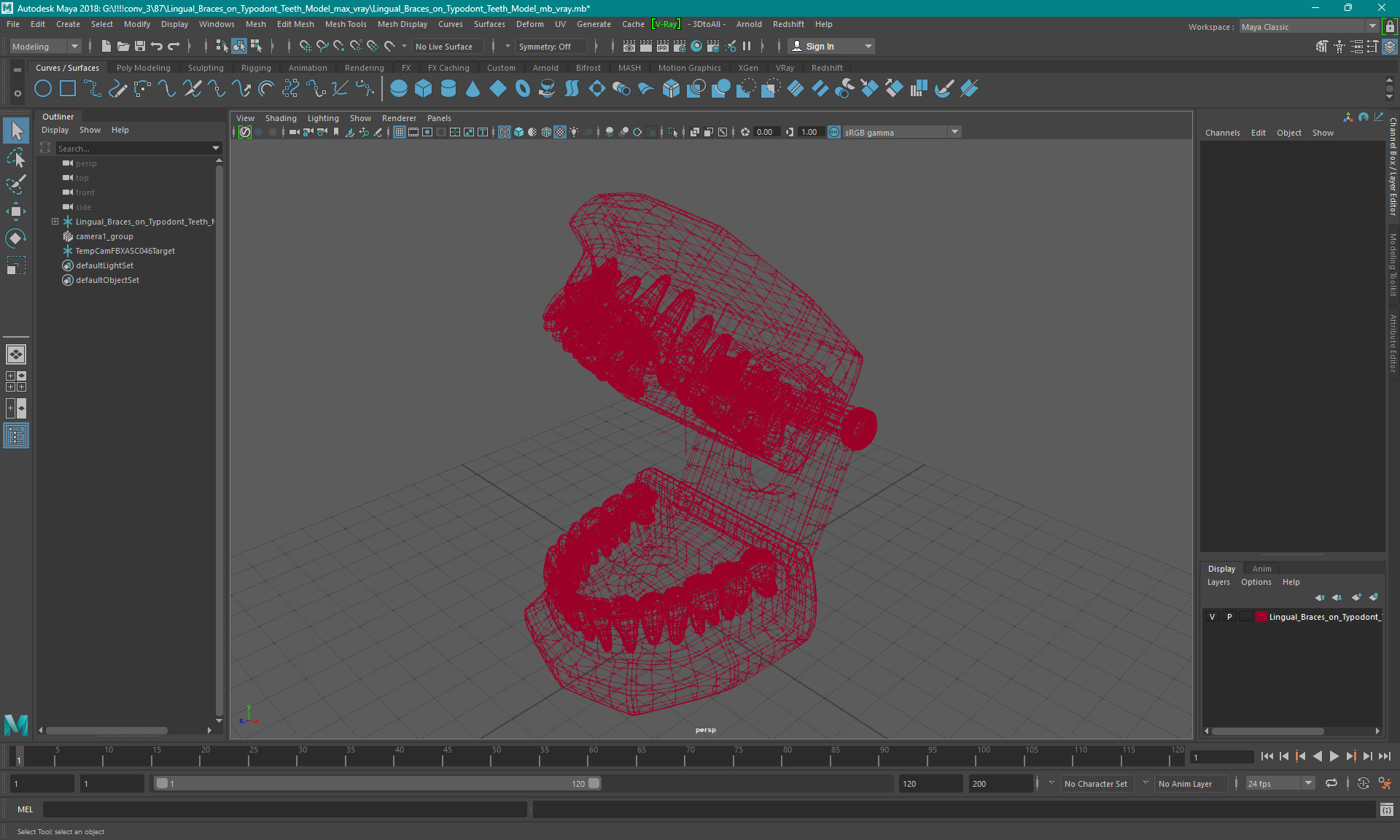 3D Lingual Braces on Typodont Teeth Model model