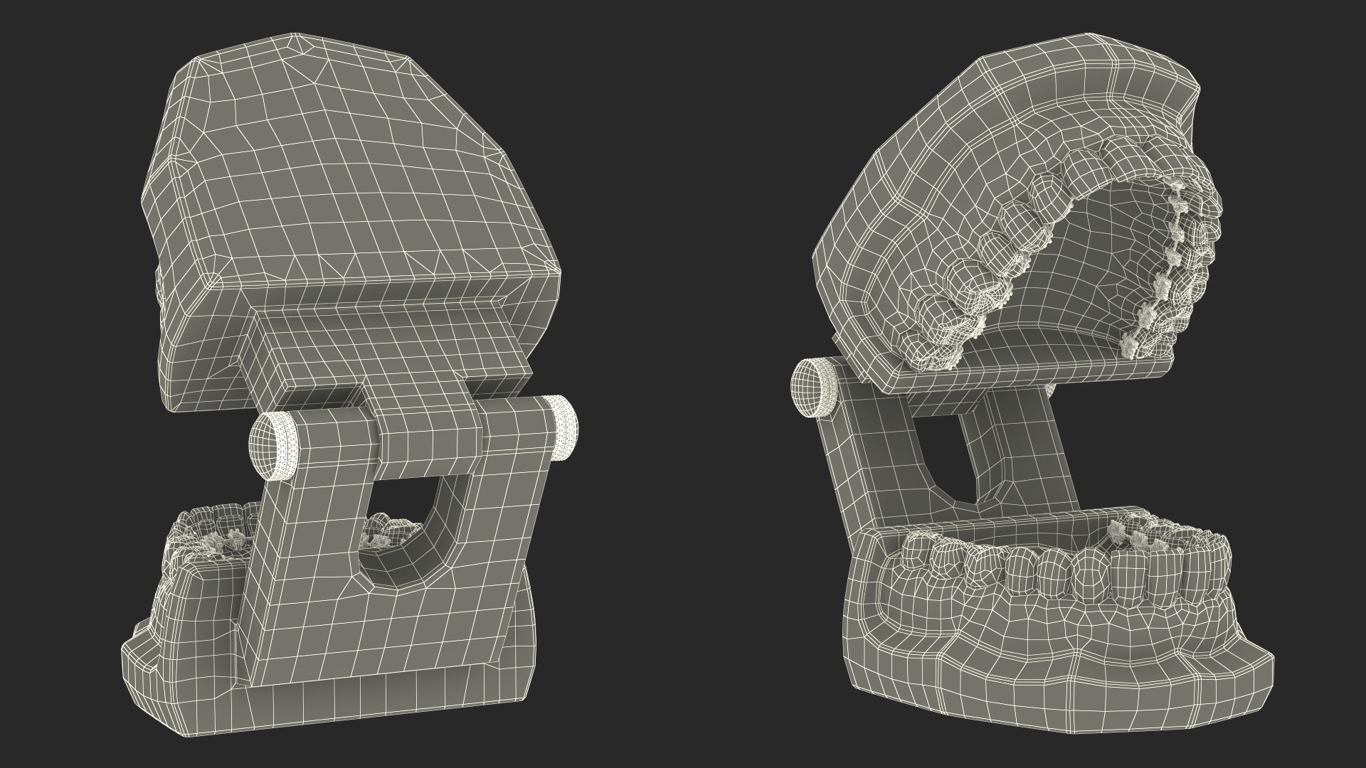 3D Lingual Braces on Typodont Teeth Model model
