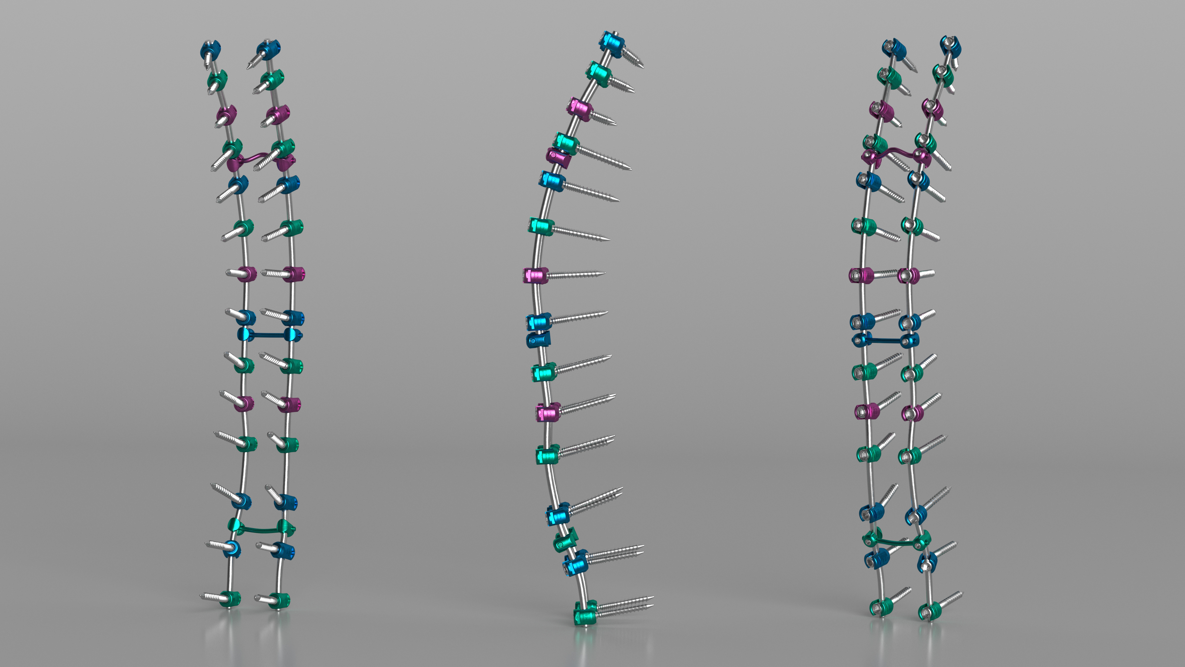 3D Thoracic Spine Fixation System Colored model