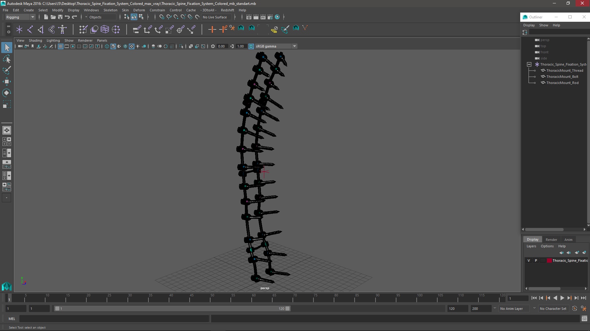 3D Thoracic Spine Fixation System Colored model