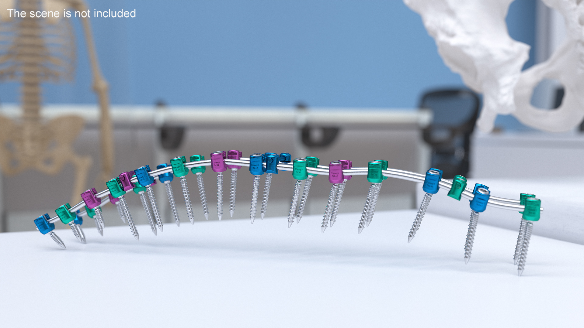 3D Thoracic Spine Fixation System Colored model