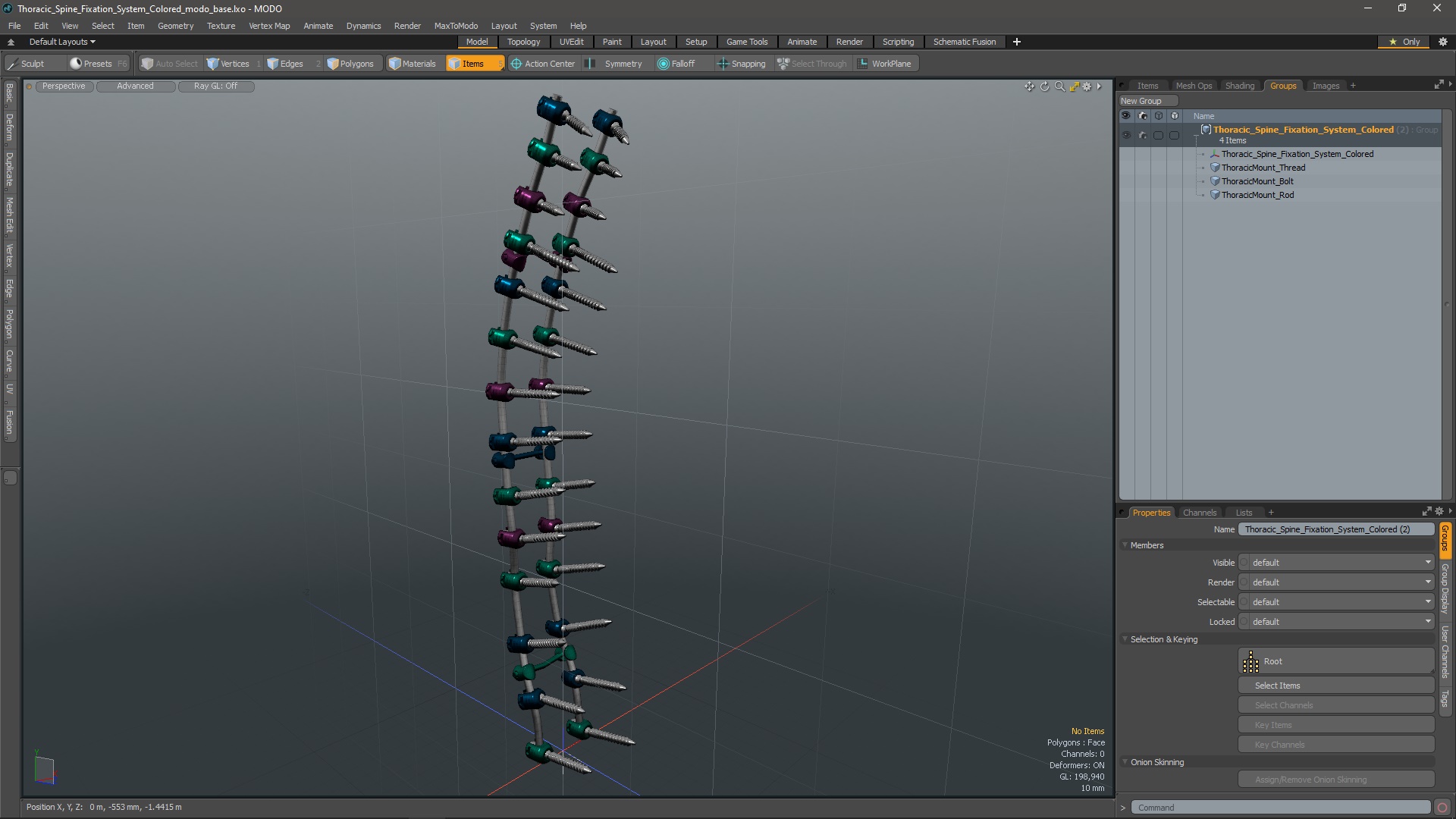 3D Thoracic Spine Fixation System Colored model