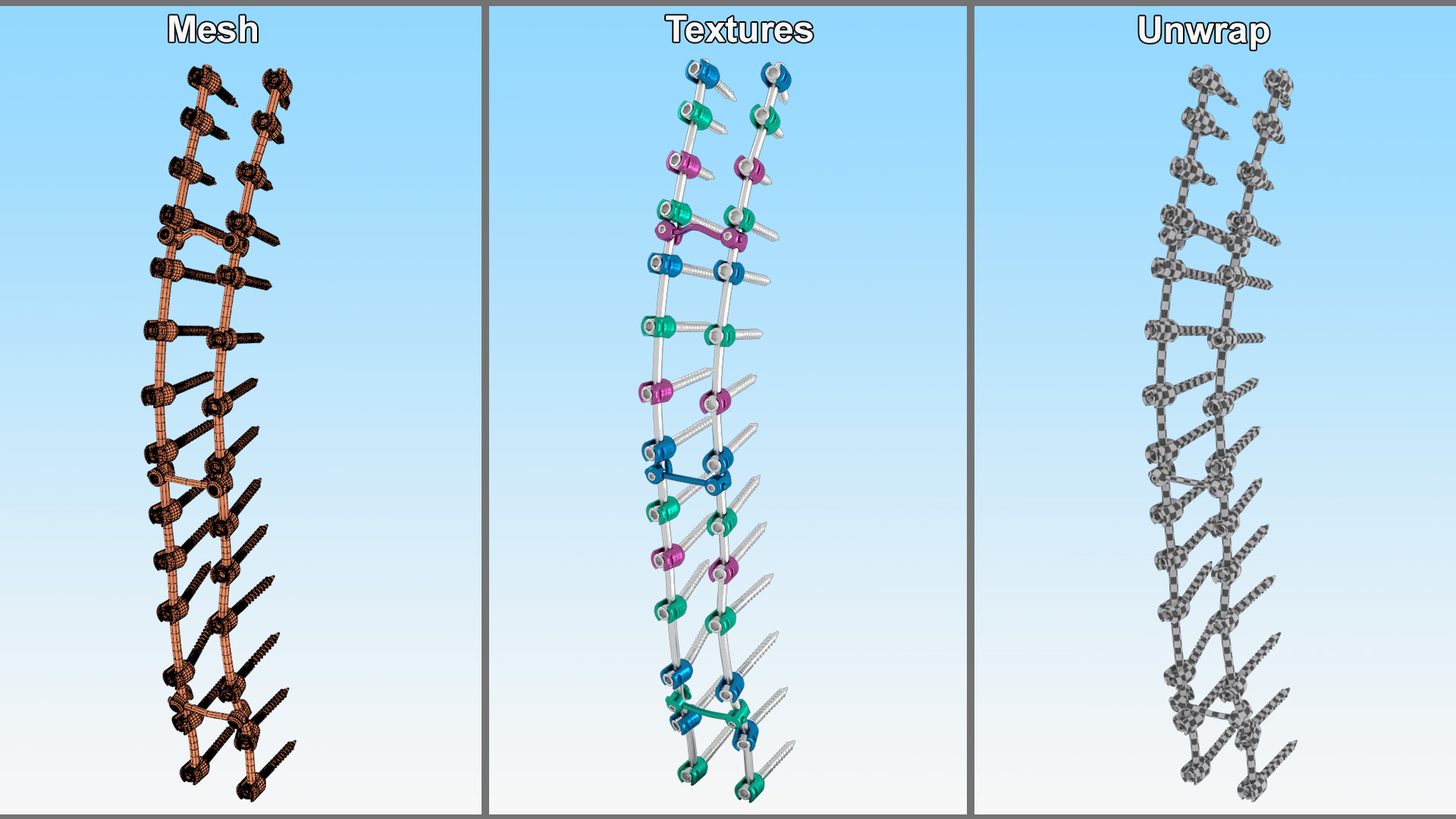 3D Thoracic Spine Fixation System Colored model