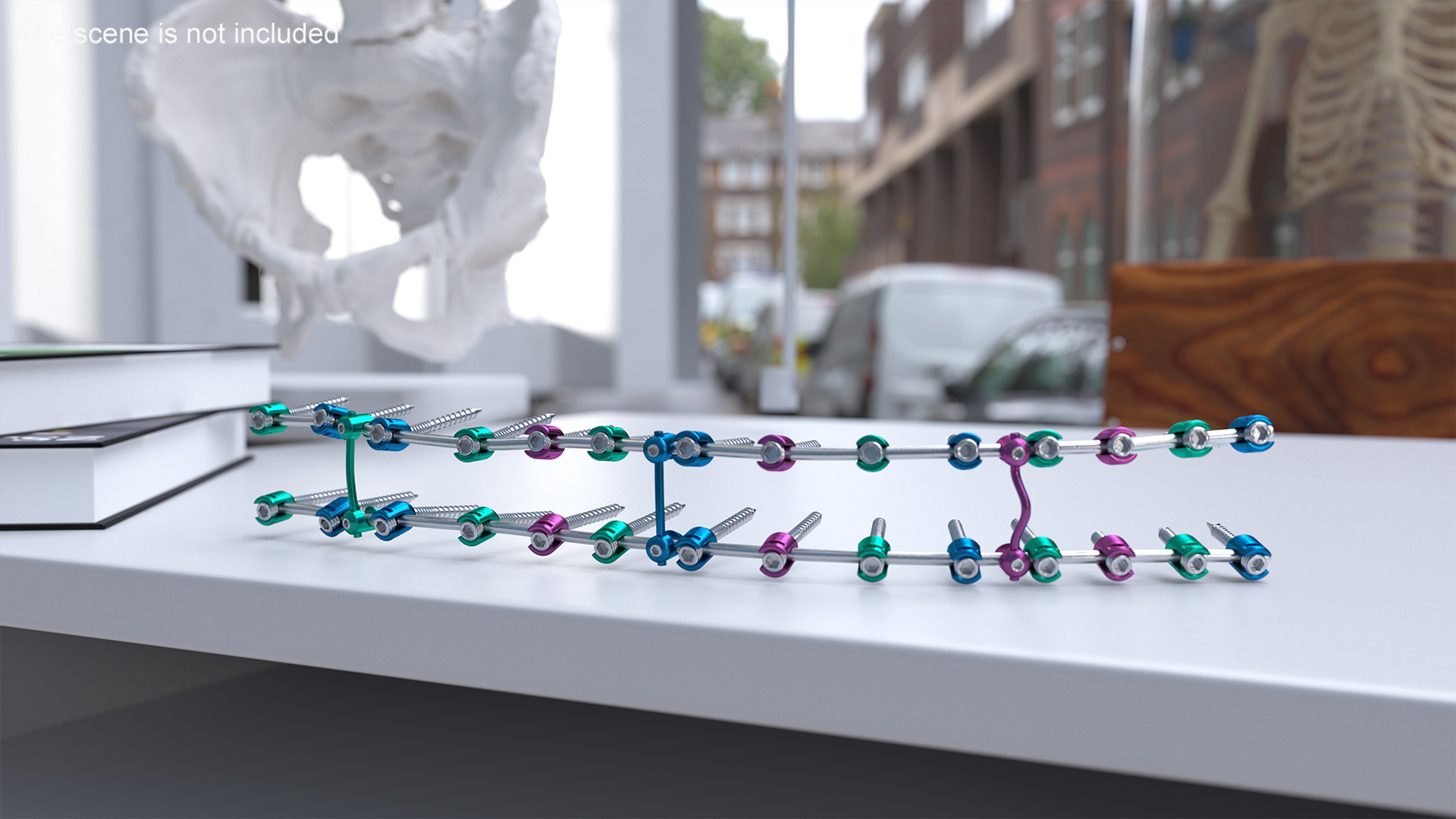 3D Thoracic Spine Fixation System Colored model