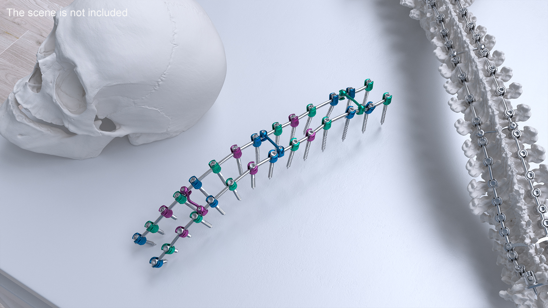 3D Thoracic Spine Fixation System Colored model