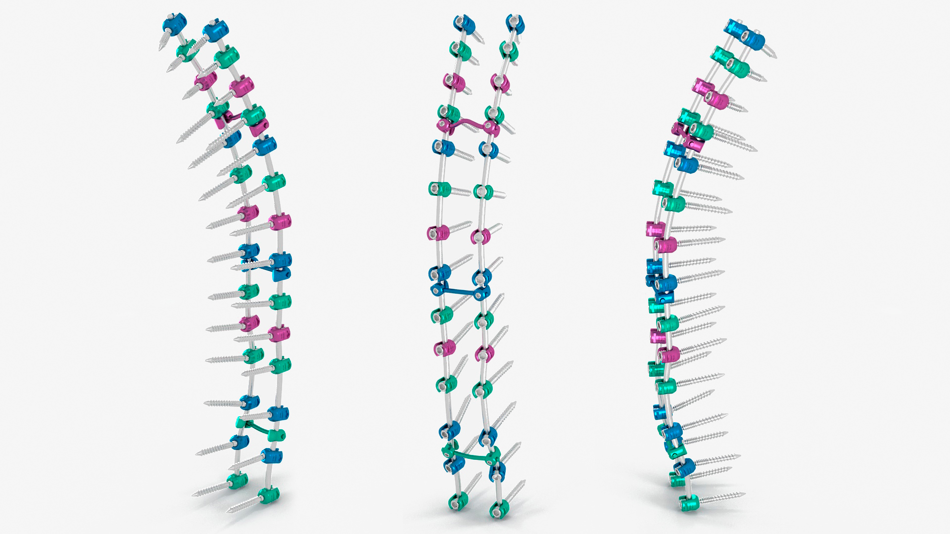 3D Thoracic Spine Fixation System Colored model