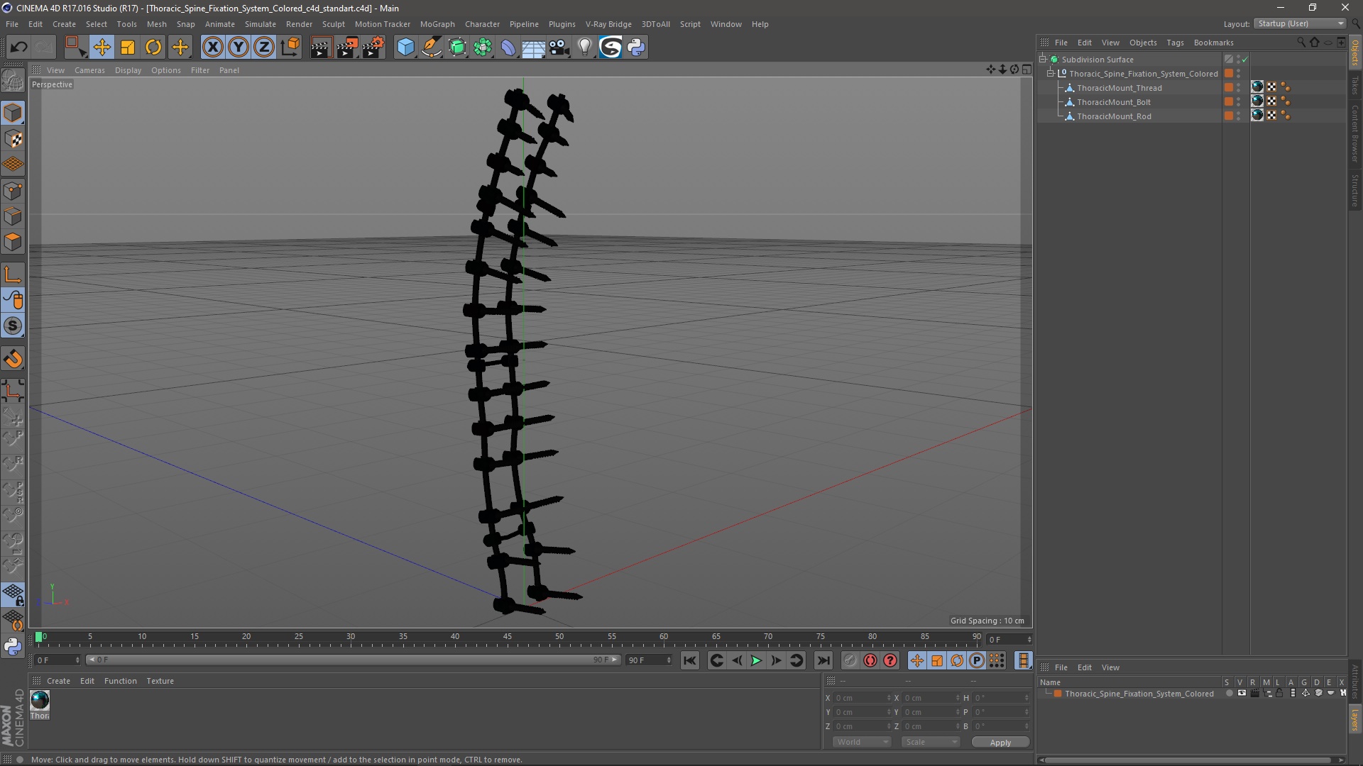 3D Thoracic Spine Fixation System Colored model
