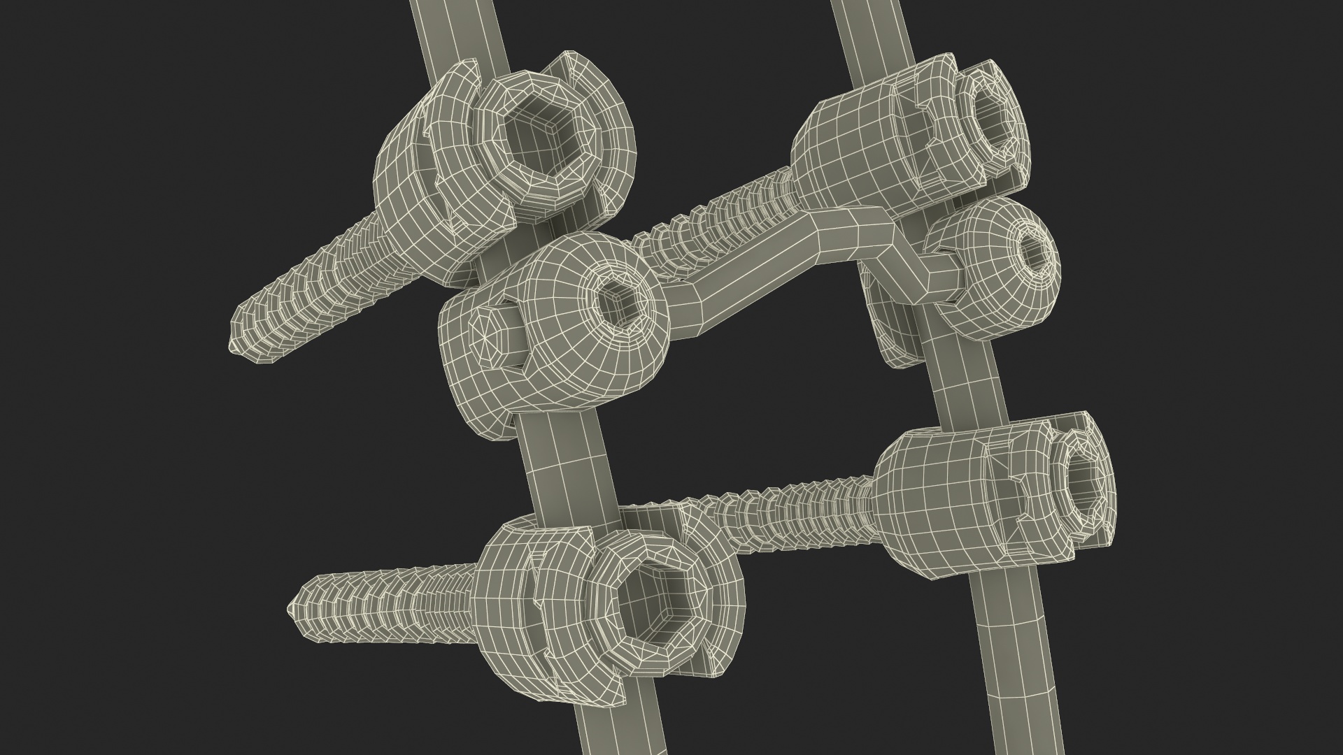 3D Thoracic Spine Fixation System Colored model