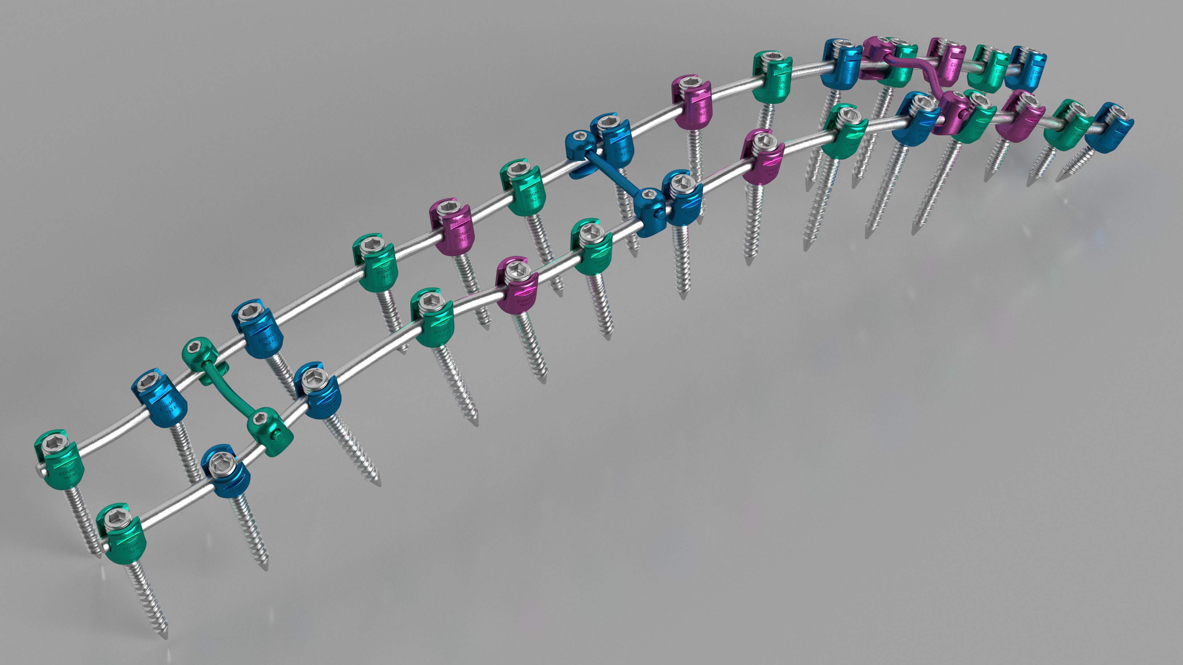 3D Thoracic Spine Fixation System Colored model