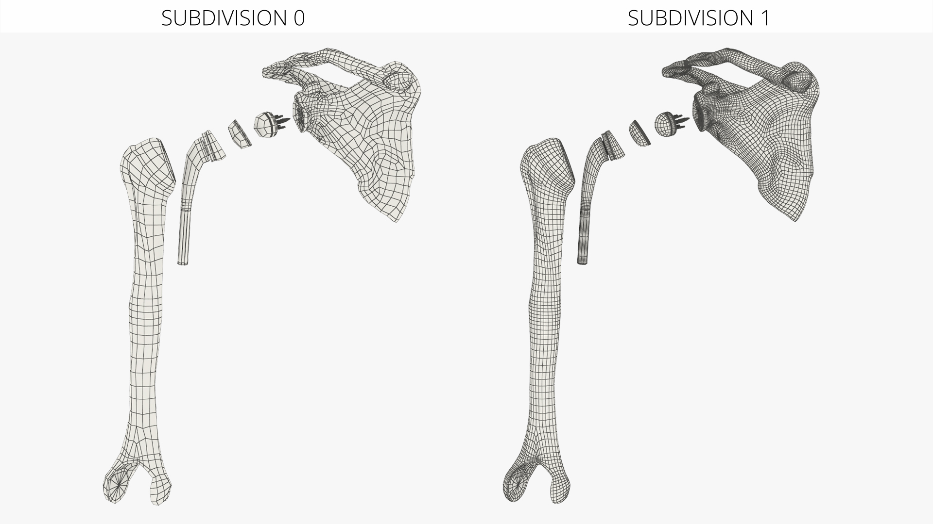 Shoulder Joint Implant with Humerus and Scapula, view 9