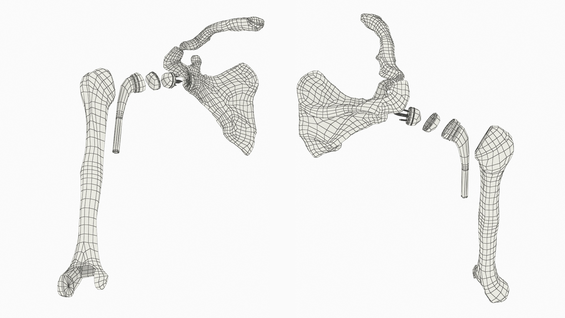 Shoulder Joint Implant with Humerus and Scapula, view 10