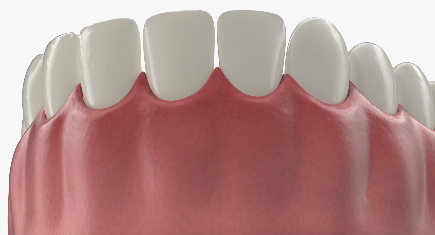 3D model Lower Teeth Medical Model With Dental Implant