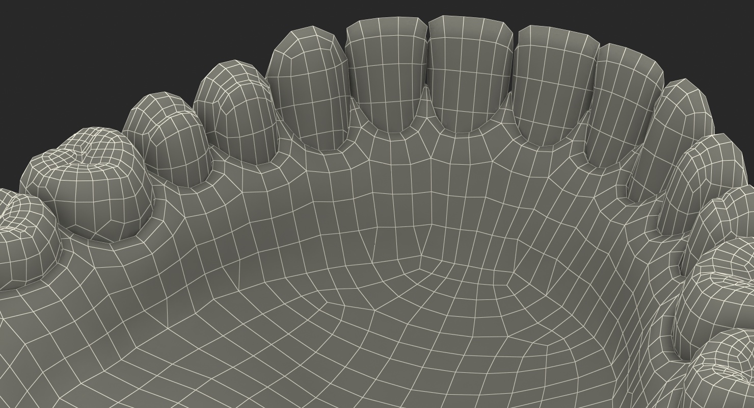 3D model Lower Teeth Medical Model With Dental Implant
