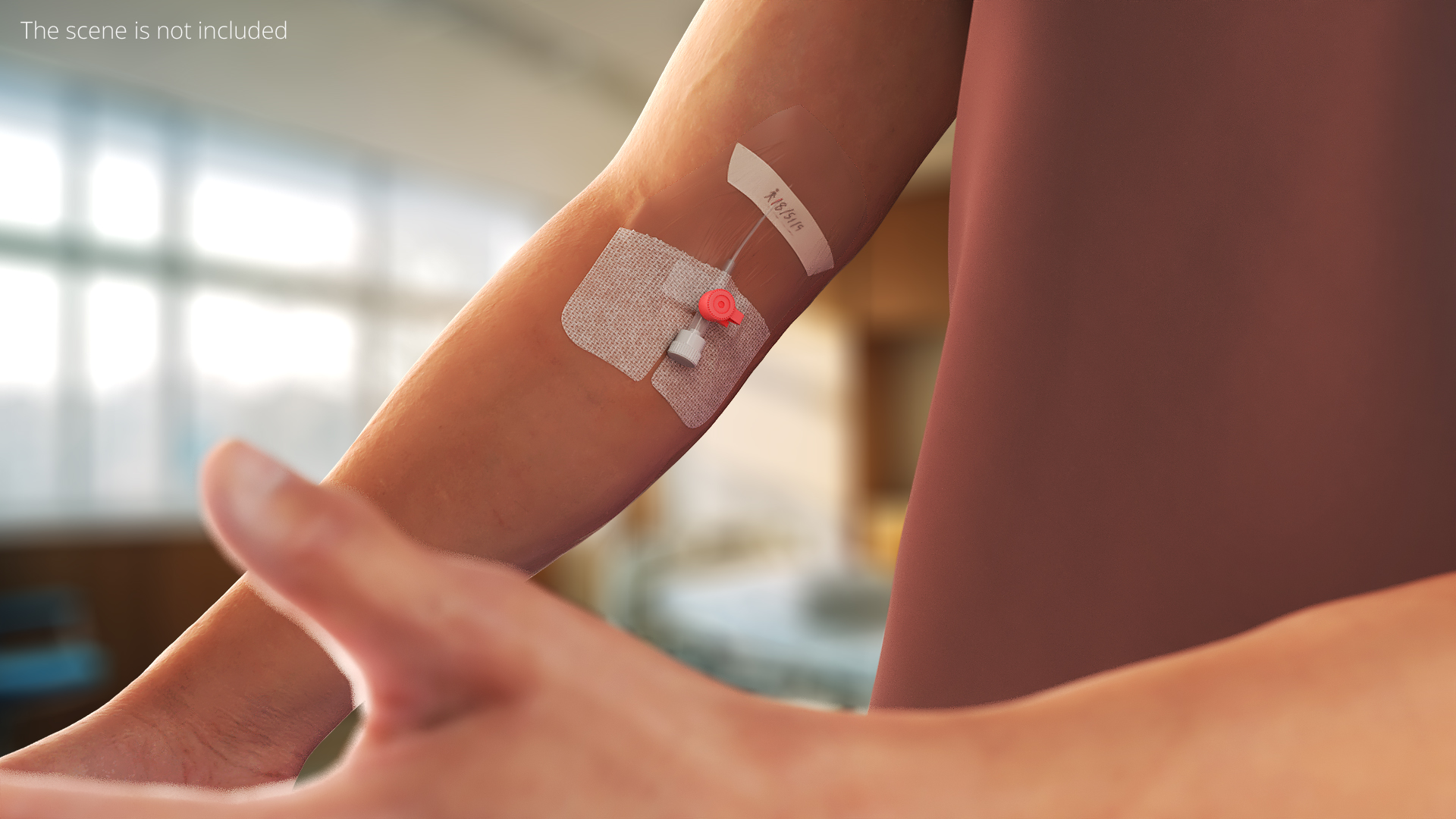 Venous Access Device with Forearm Fixation - view 3