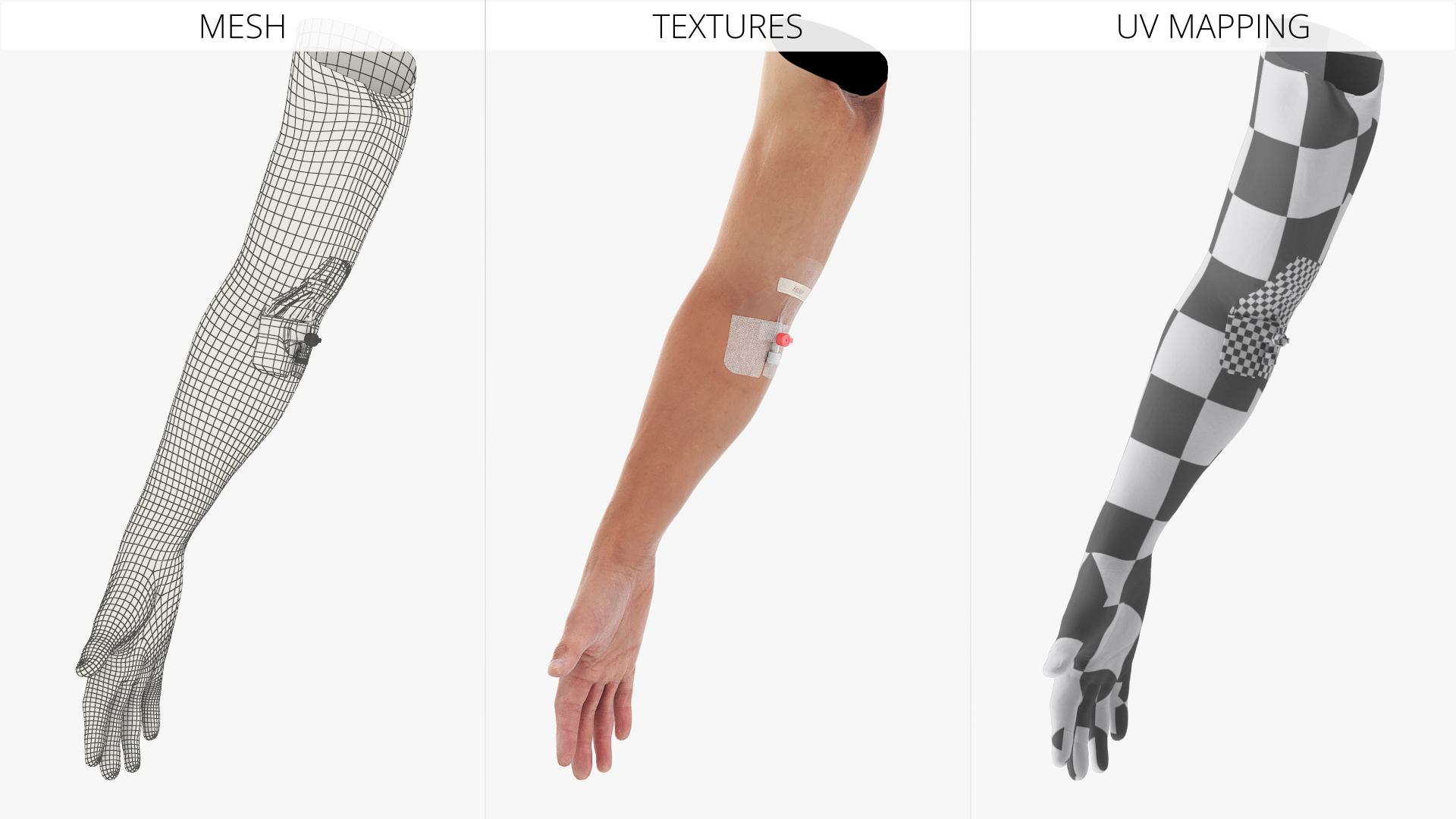 Venous Access Device with Forearm Fixation - view 8