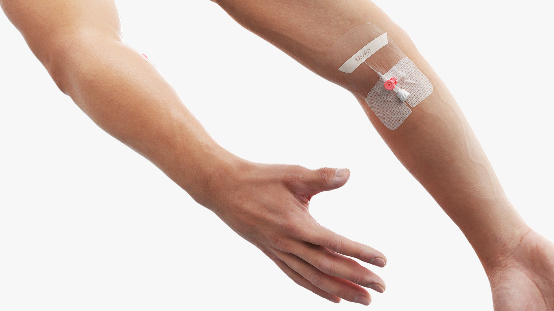 Venous Access Device with Forearm Fixation - view 5