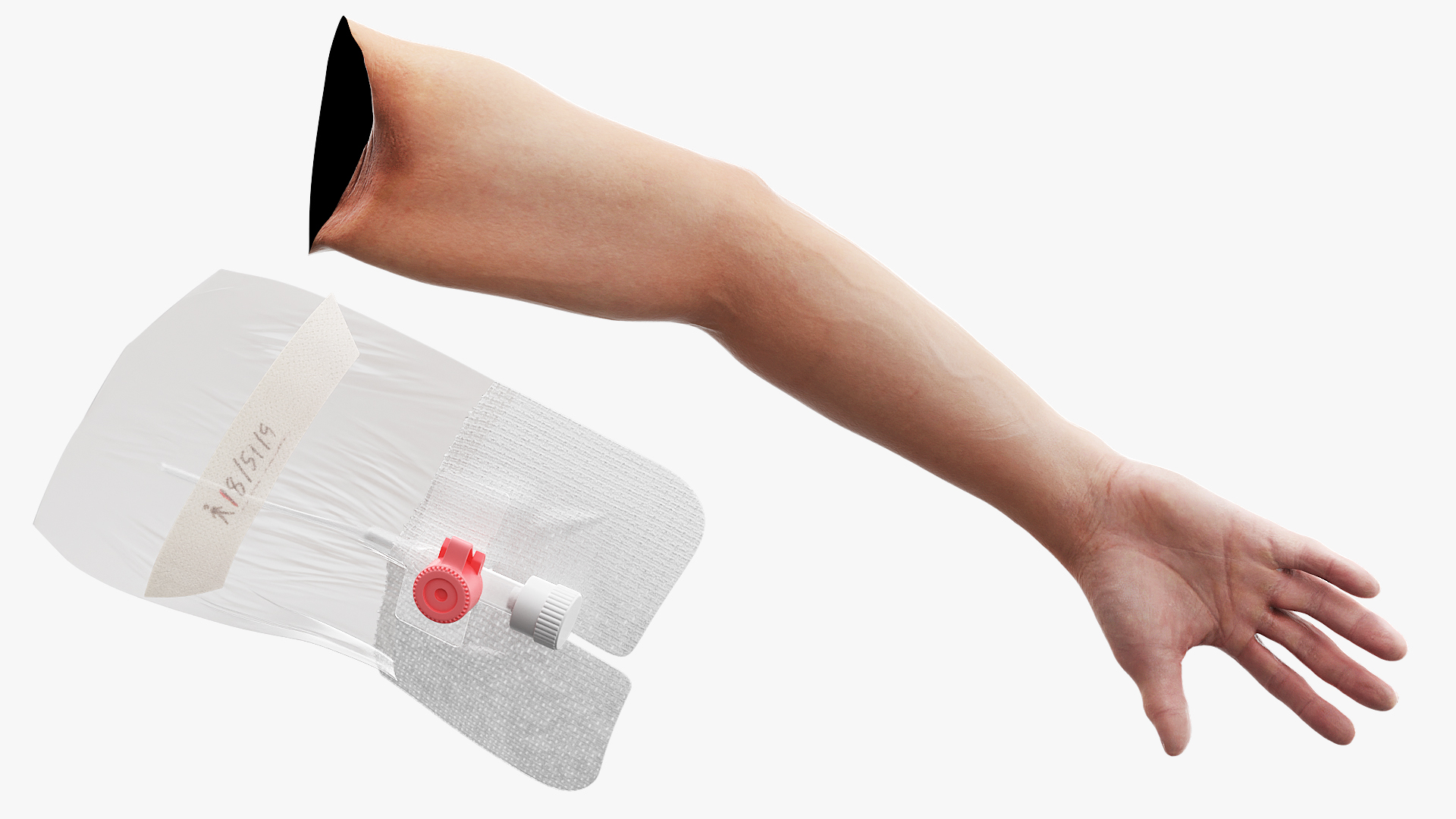 Venous Access Device with Forearm Fixation - view 7