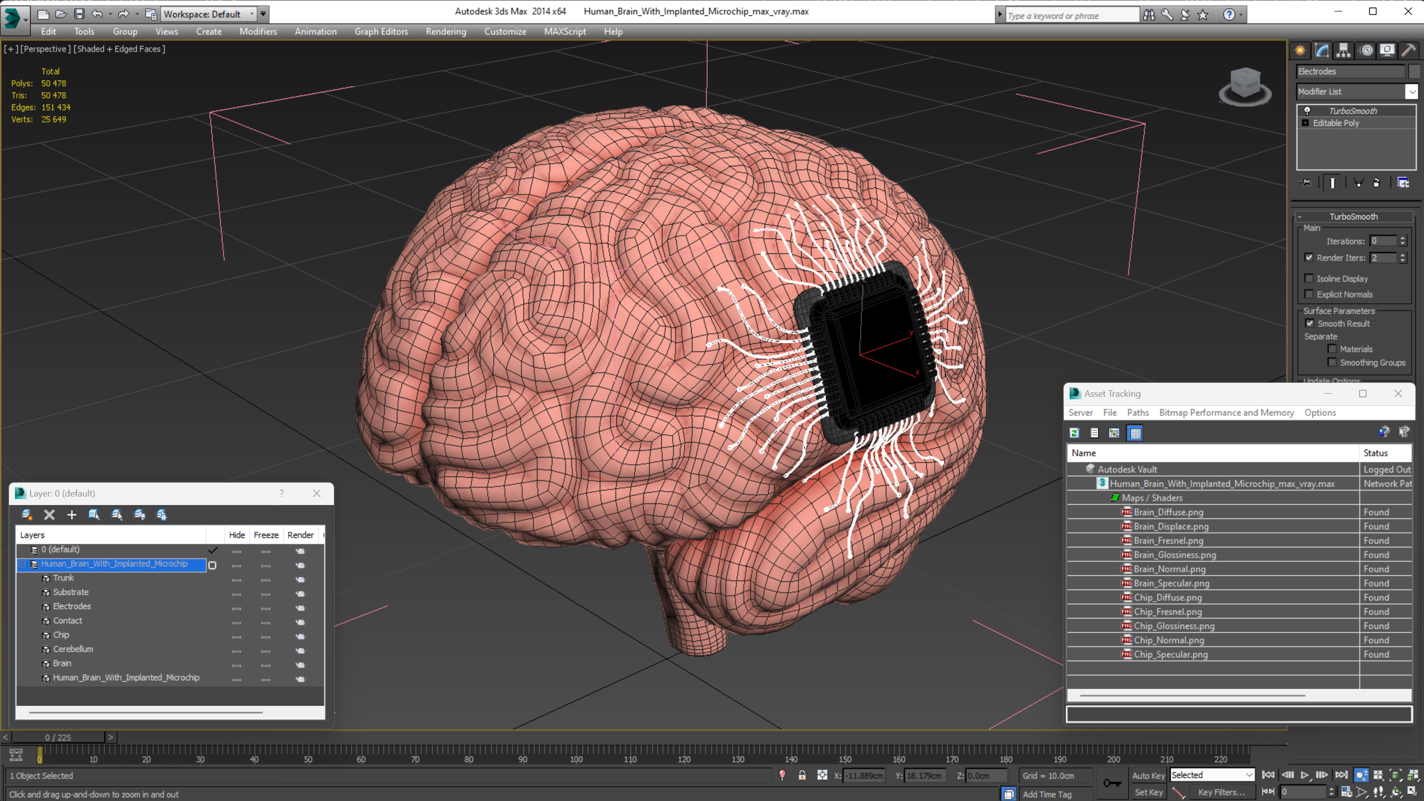 3D Human Brain With Implanted Microchip