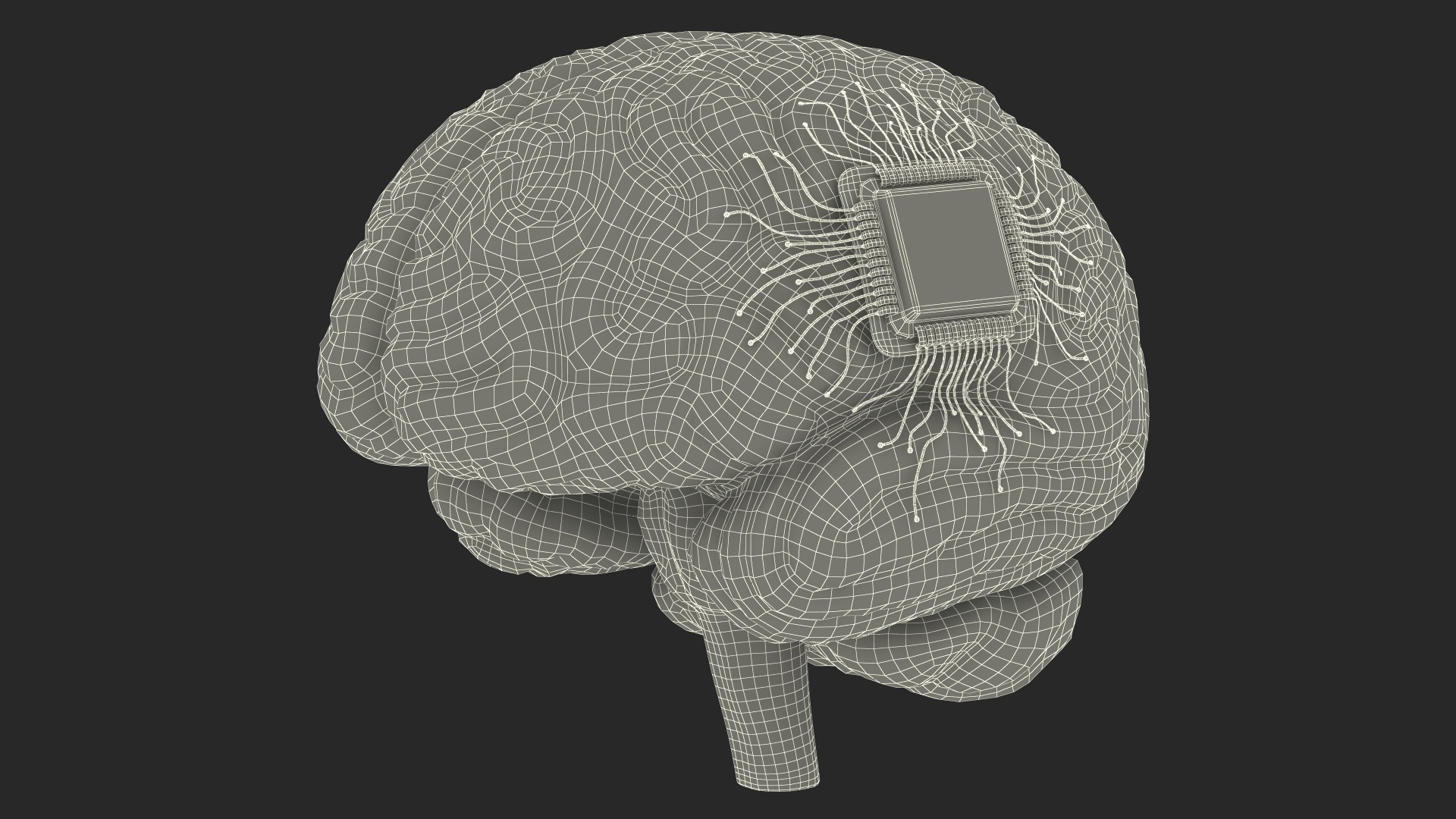 3D Human Brain With Implanted Microchip