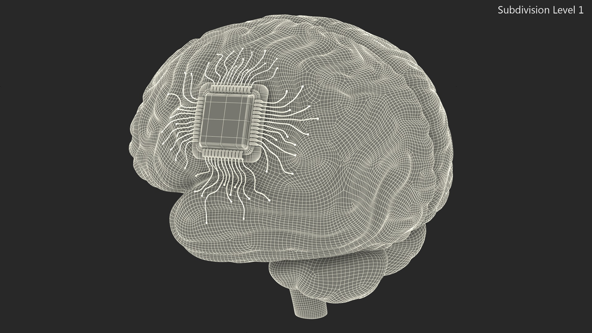 3D Human Brain With Implanted Microchip