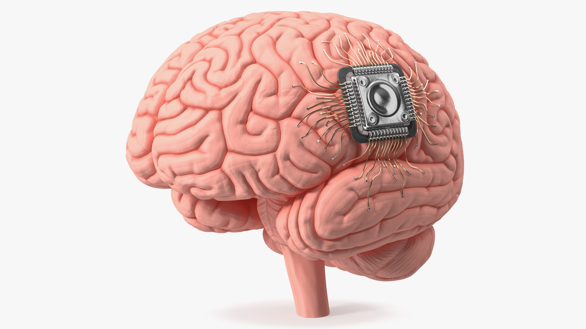 3D Human Brain With Implanted Microchip