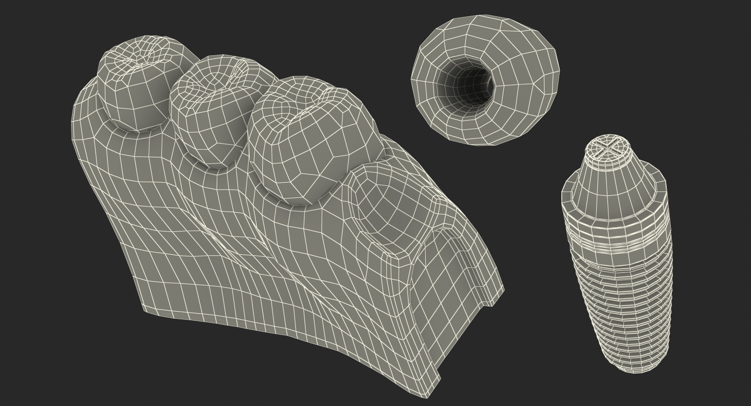 Education Tooth Implant Model 3D model