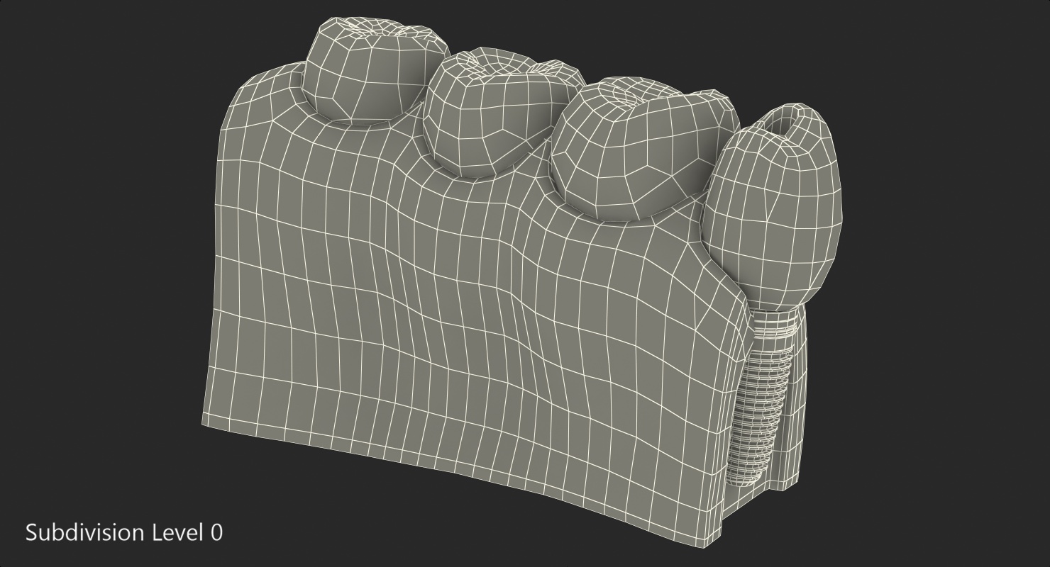 Education Tooth Implant Model 3D model