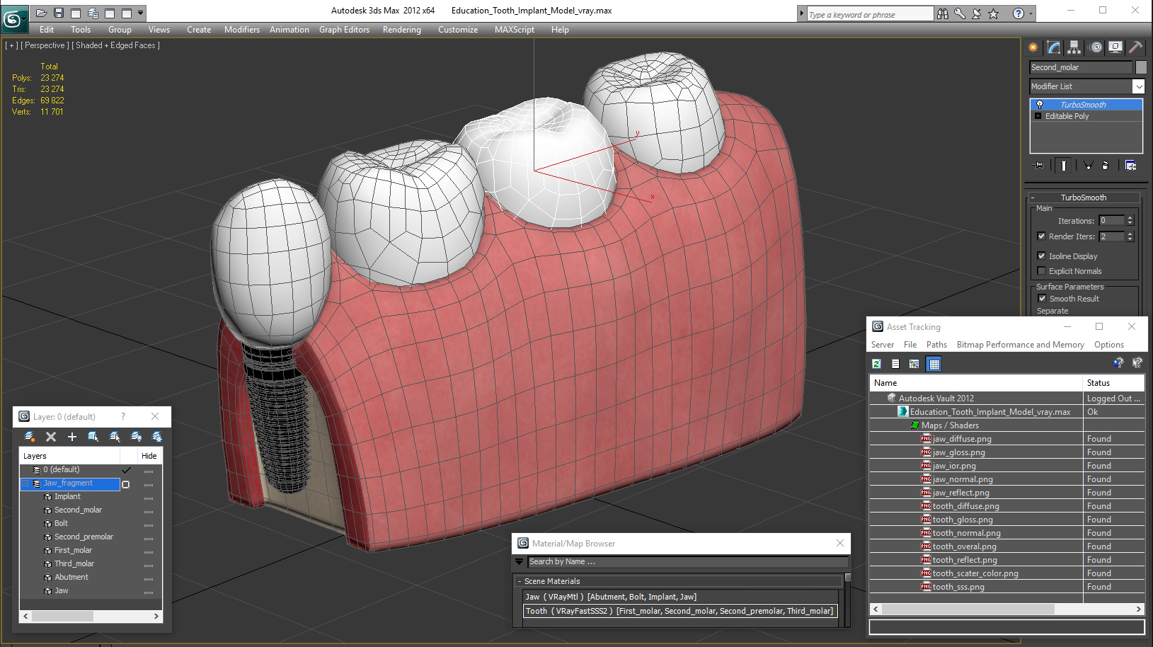 Education Tooth Implant Model 3D model