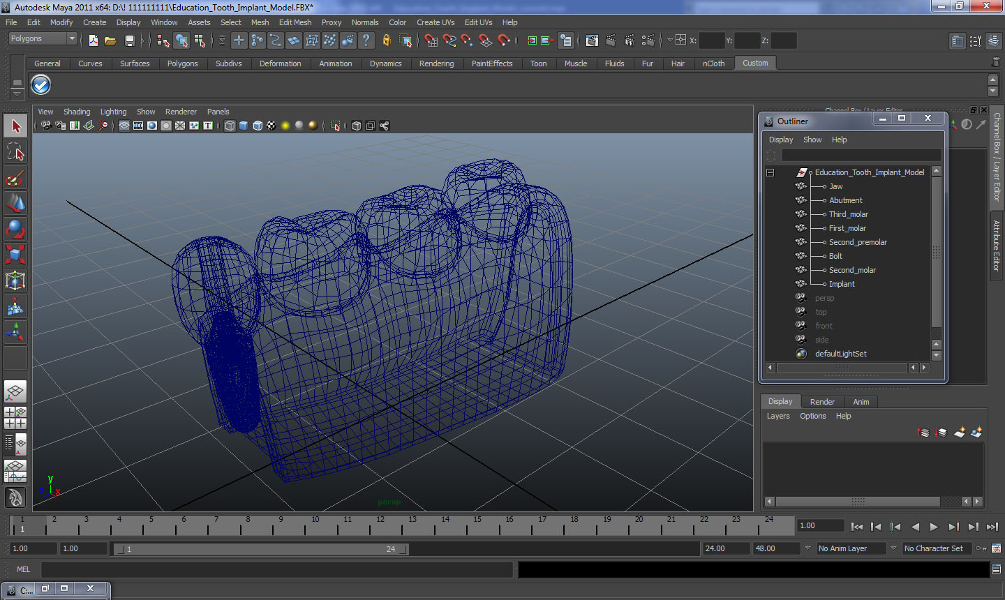 Education Tooth Implant Model 3D model