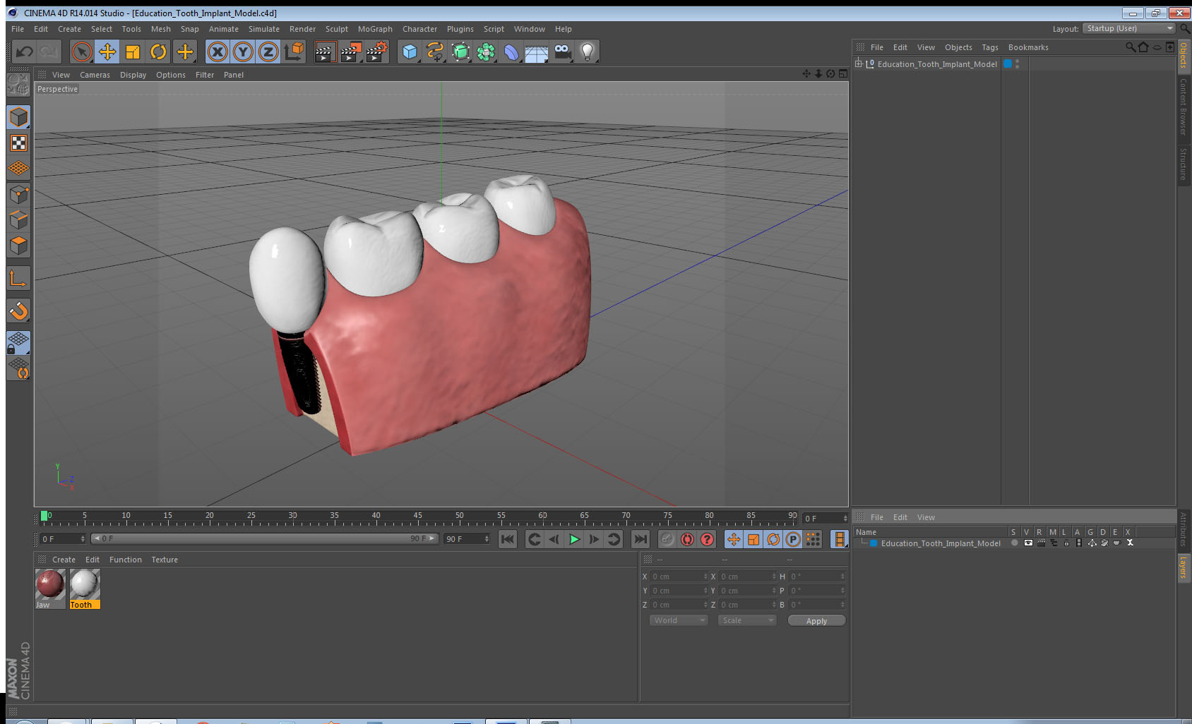 Education Tooth Implant Model 3D model