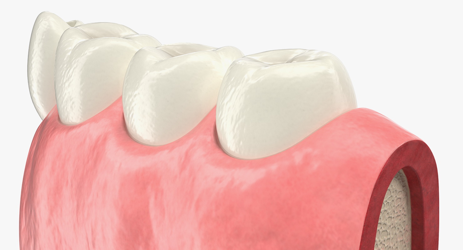 Education Tooth Implant Model 3D model