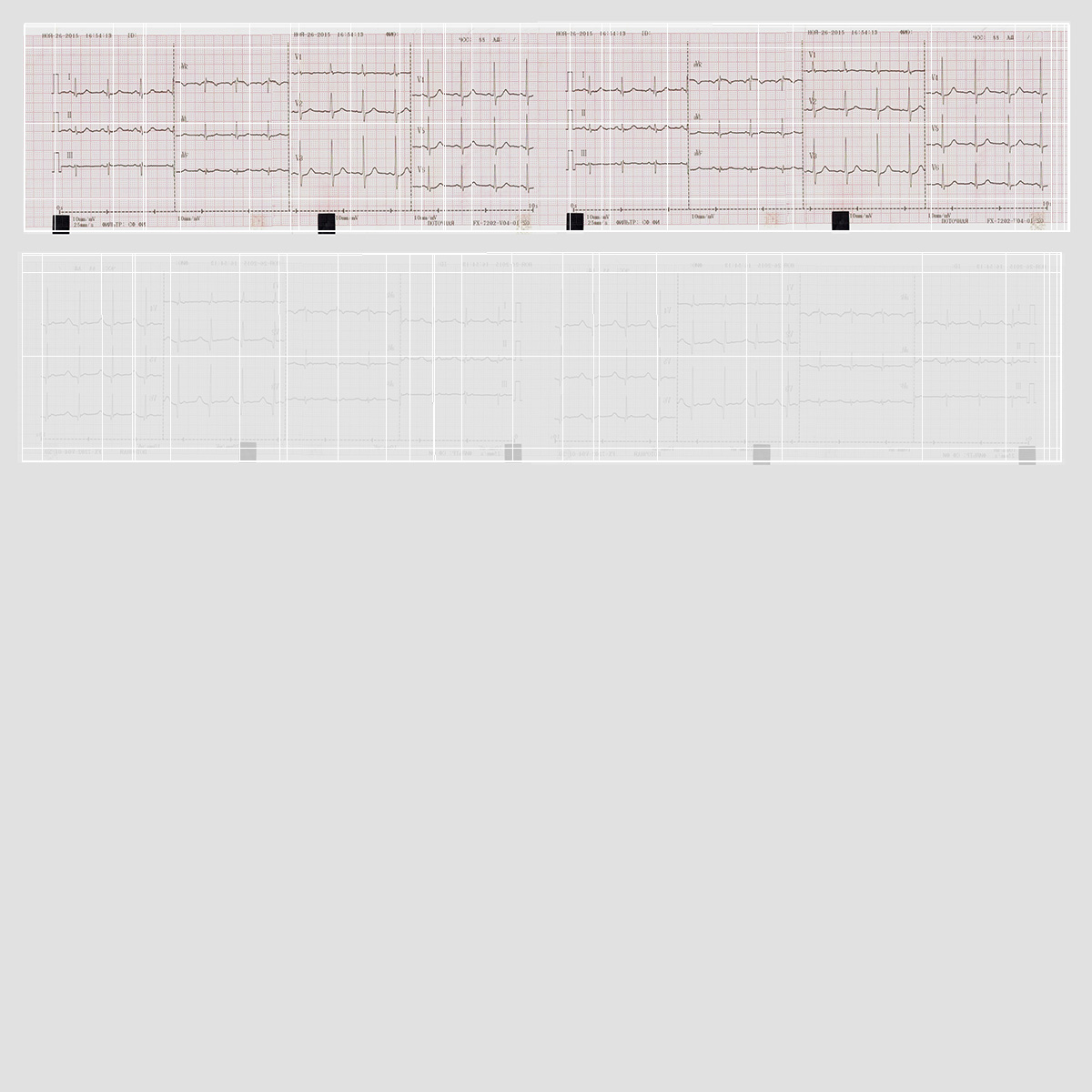 Medical ECG Paper Roll 3D