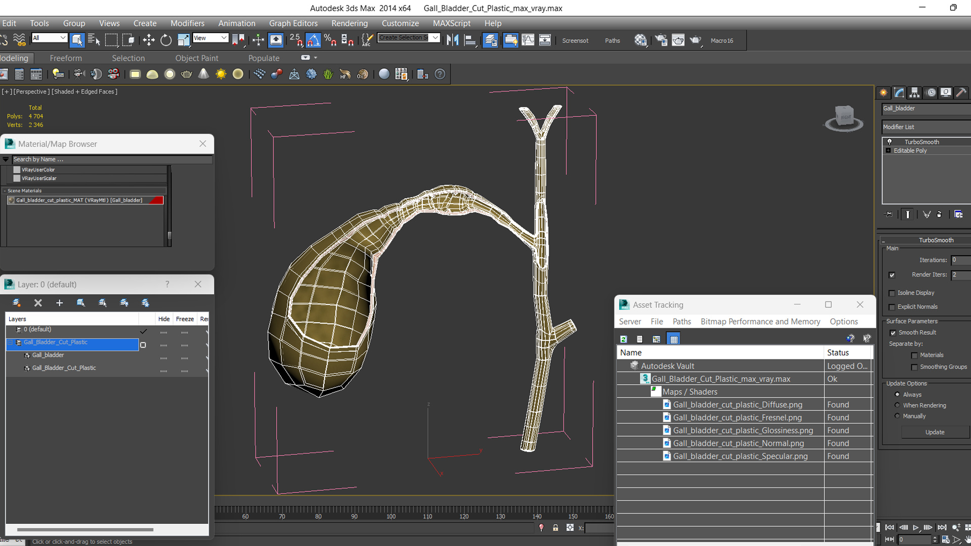 Gall Bladder Cut Plastic 3D model