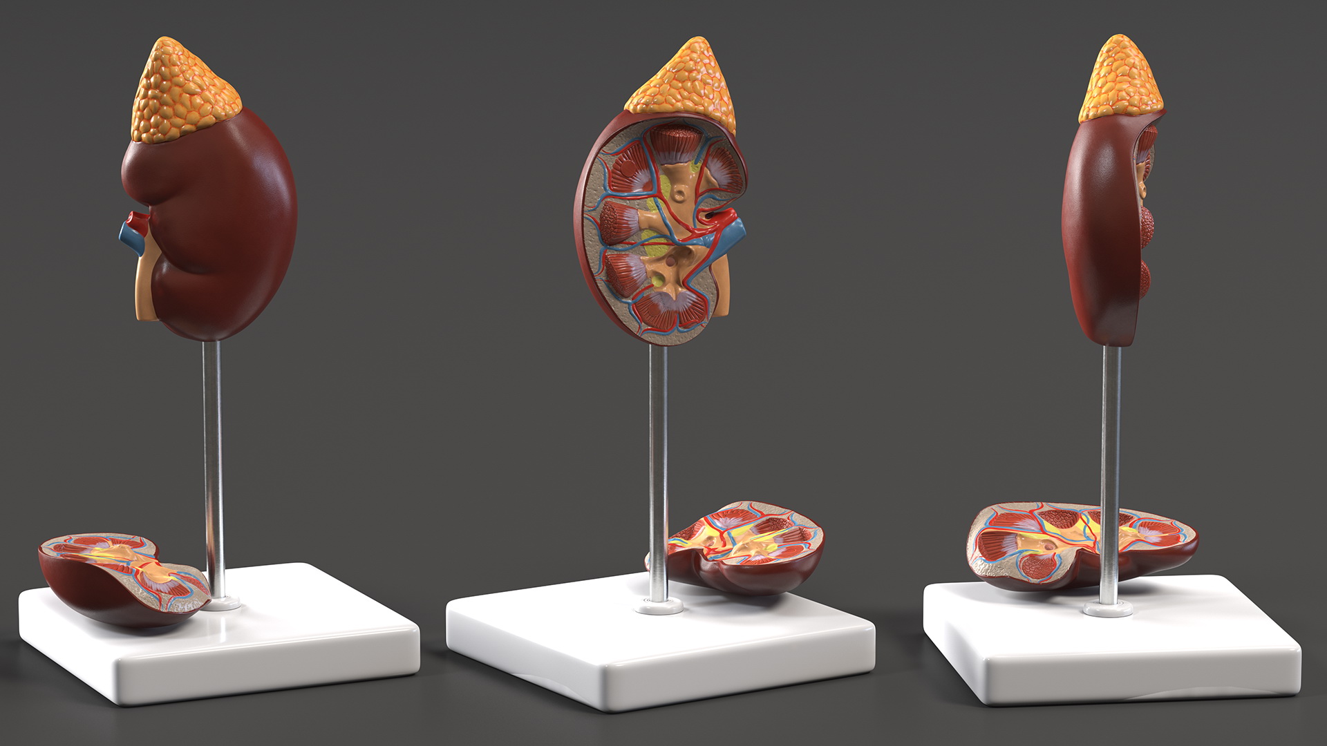 3D Kidney Anatomical Model model